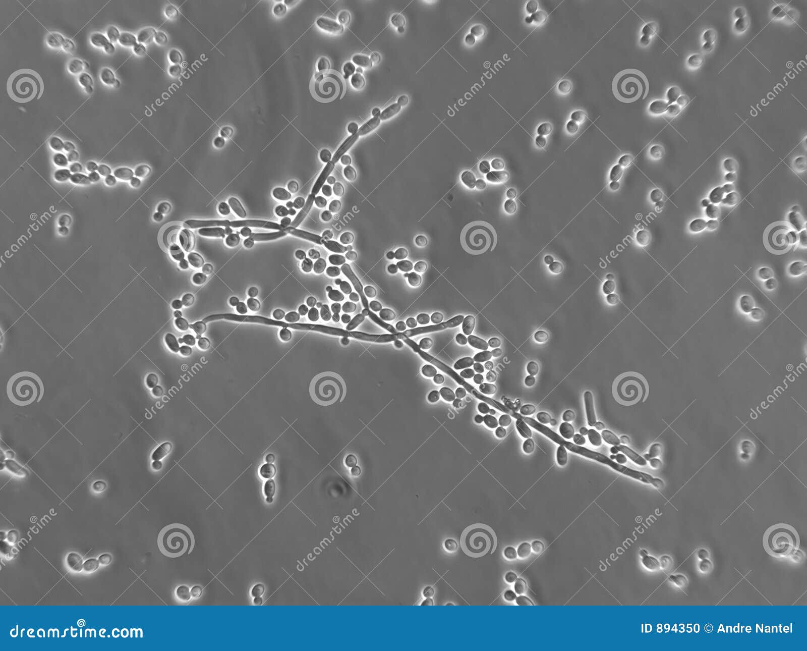 Споры candida. Кандида альбиканс под микроскопом. Грибок Candida под микроскопом. Контагиозный моллюск микроскопия. Грибы рода кандида под микроскопом.