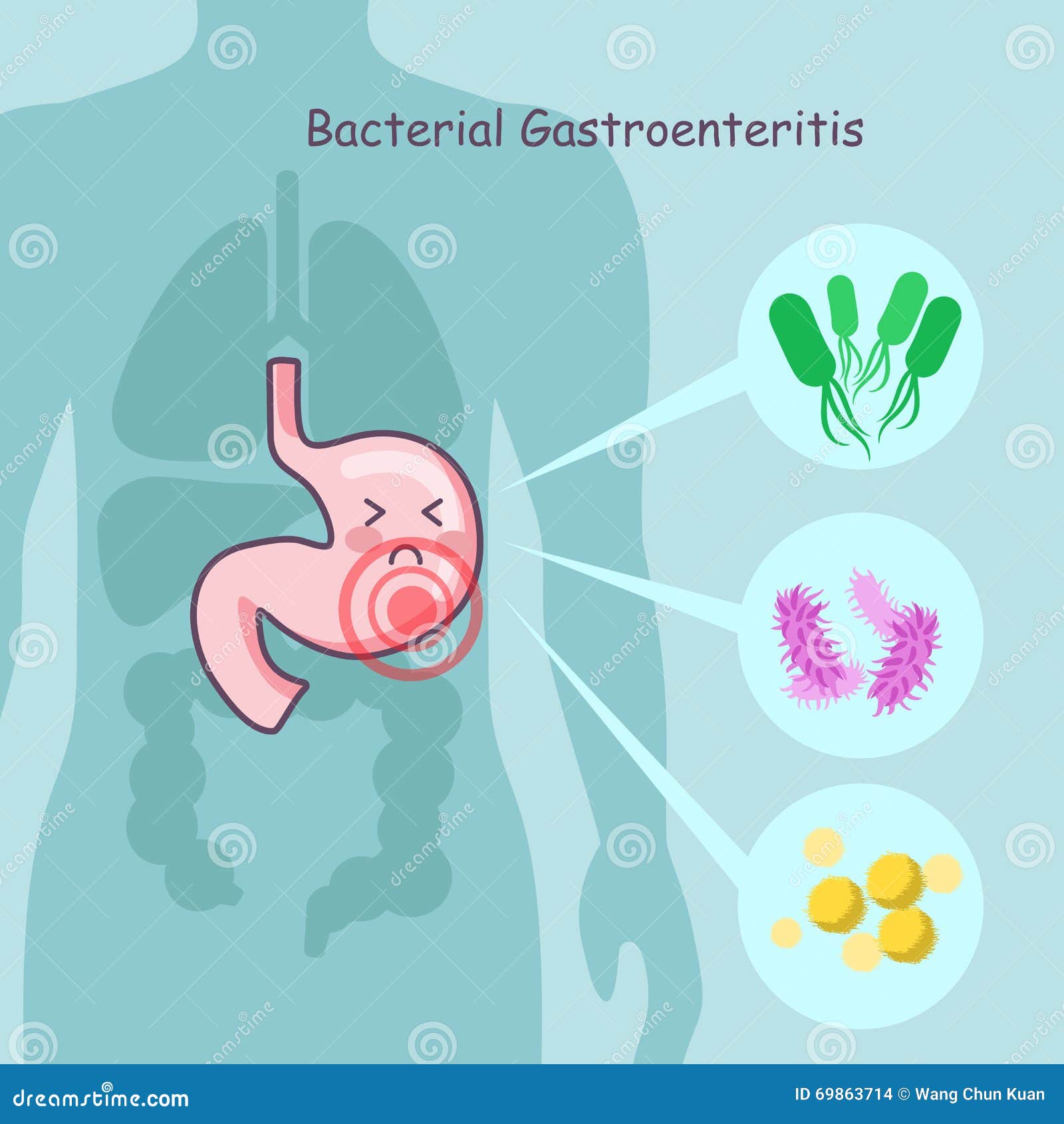 stomach bacterial gastroenteritis cute cartoon great health care concept 69863714