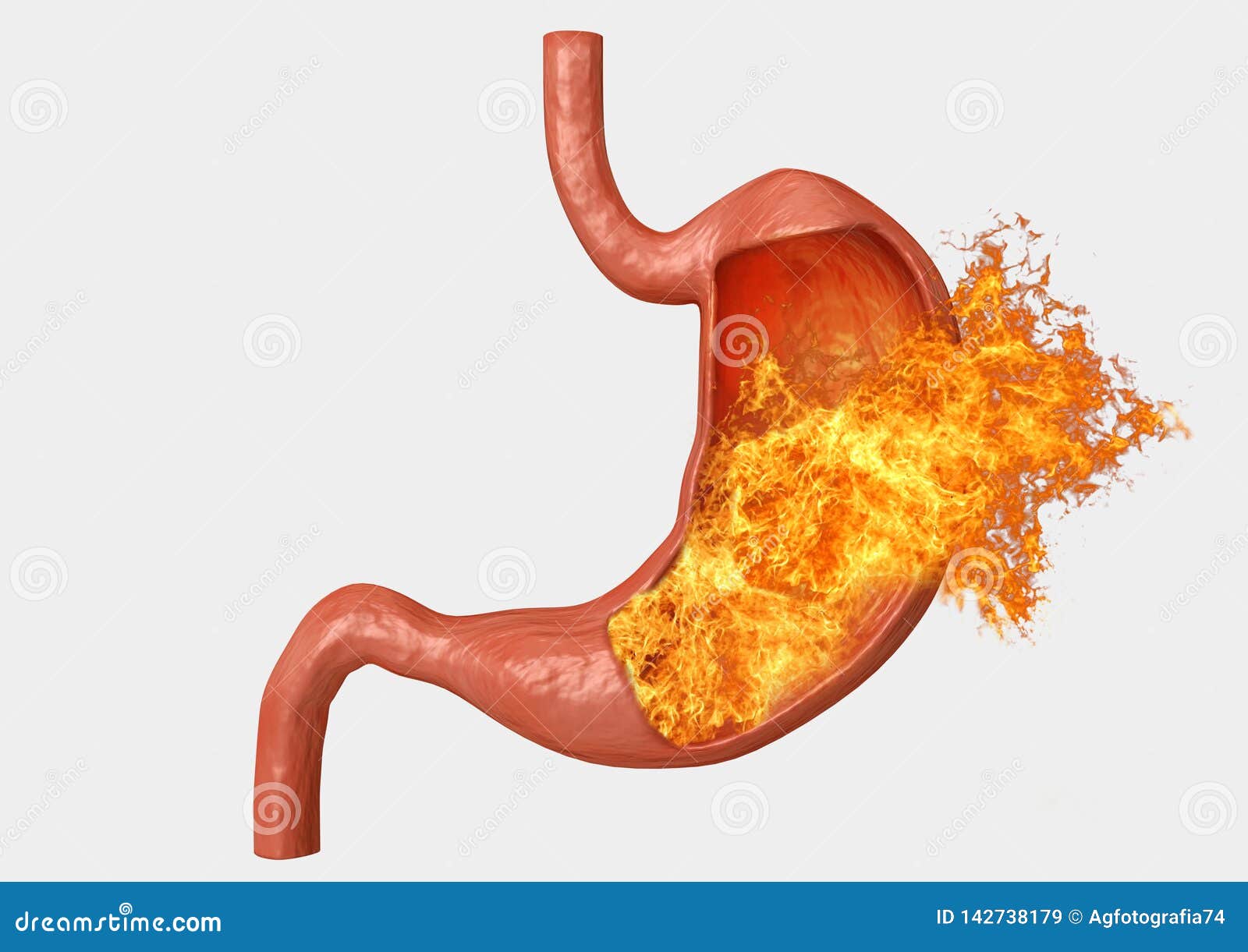 stomach fire. excessive acidity, indigestion, stomach disease, gastric ulcer, severe abdominal pain