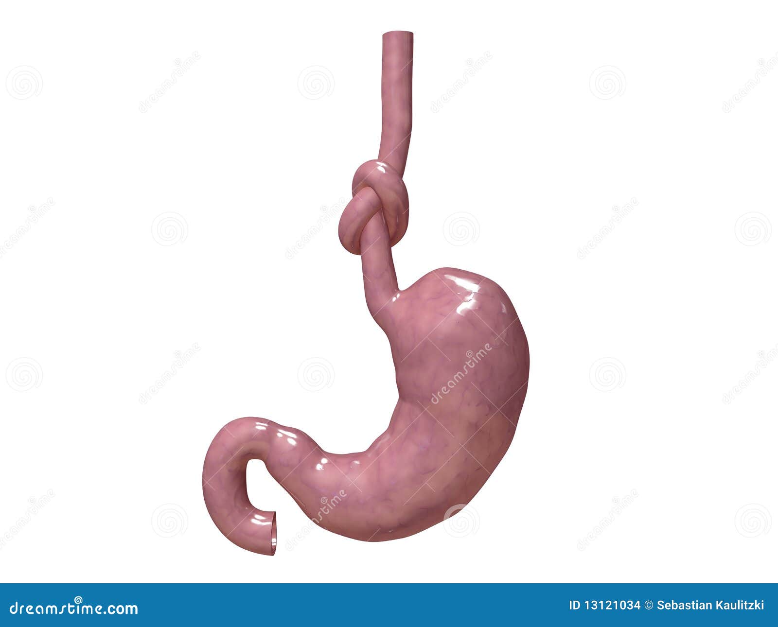 Stomach knot stock illustration. Illustration of gastric 13121034