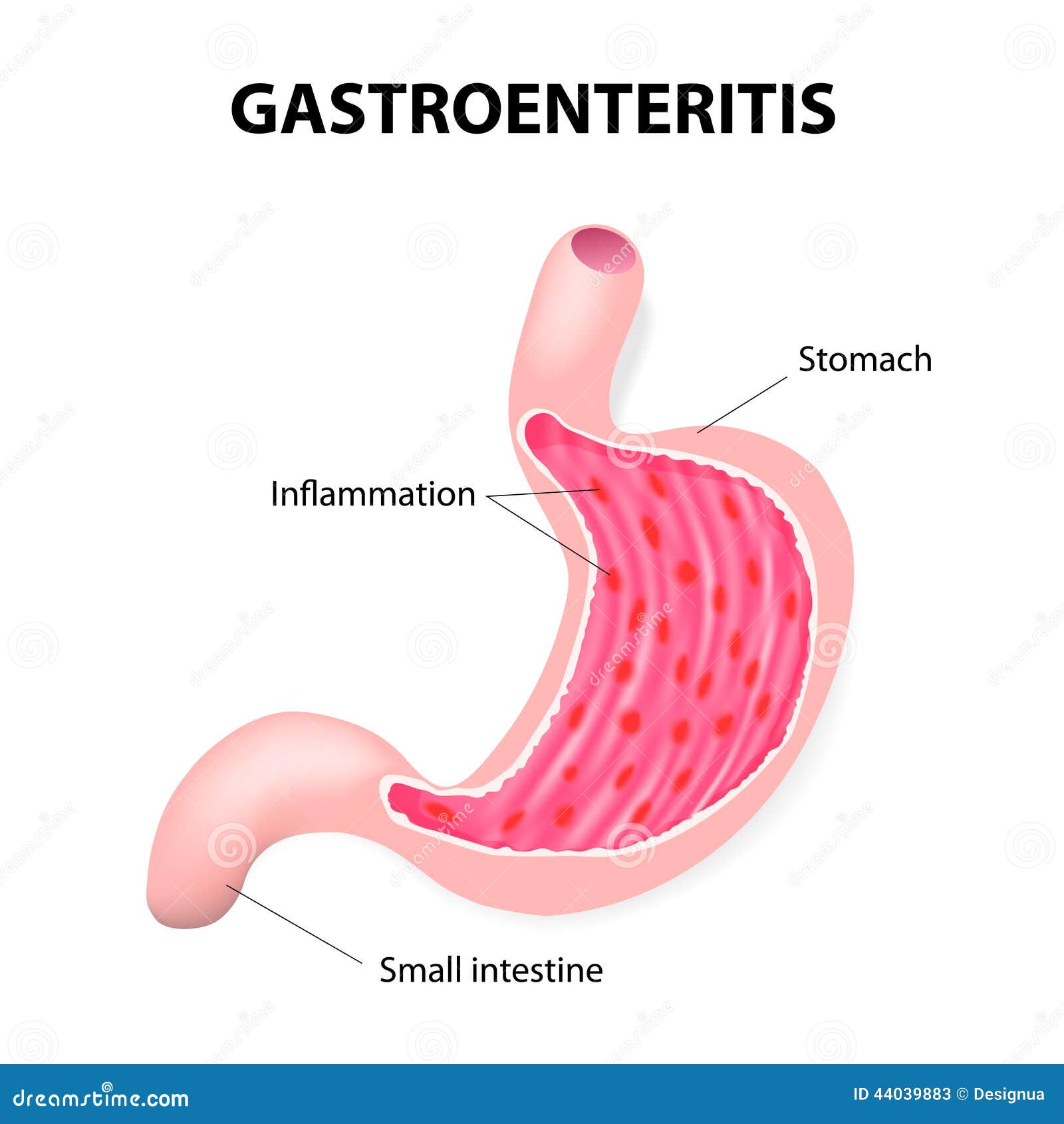 stomach virus