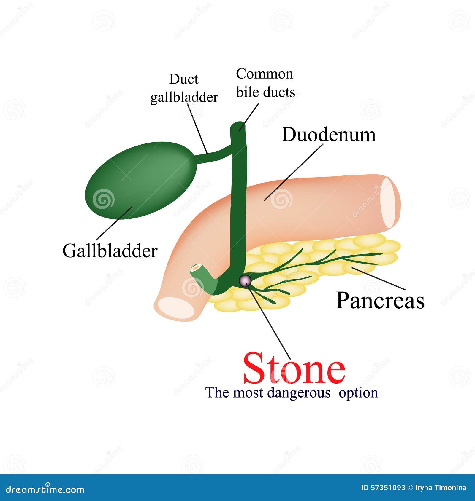 pancreas bile duct blockblock symptoms pancreas bile duct blockblock symptoms