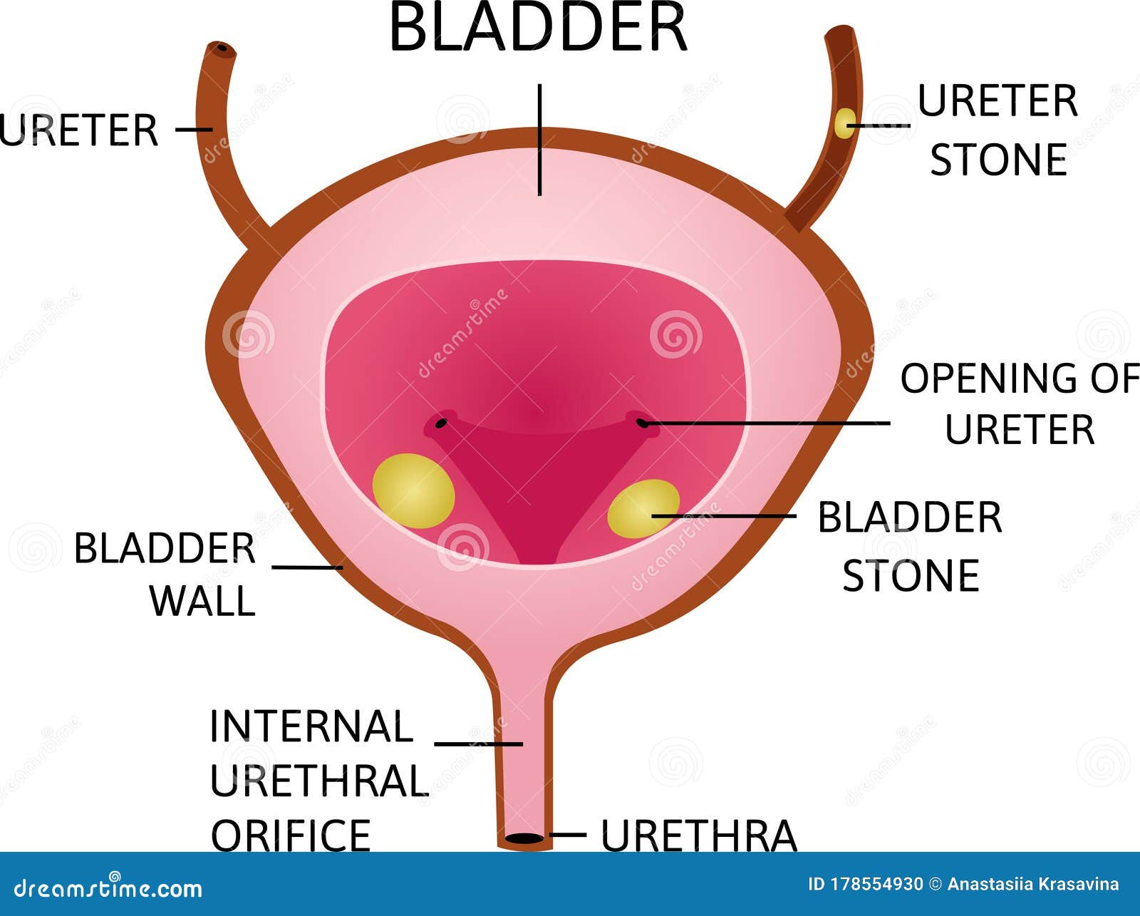 Bladder pressure no pain peeing in squirts comes and goes