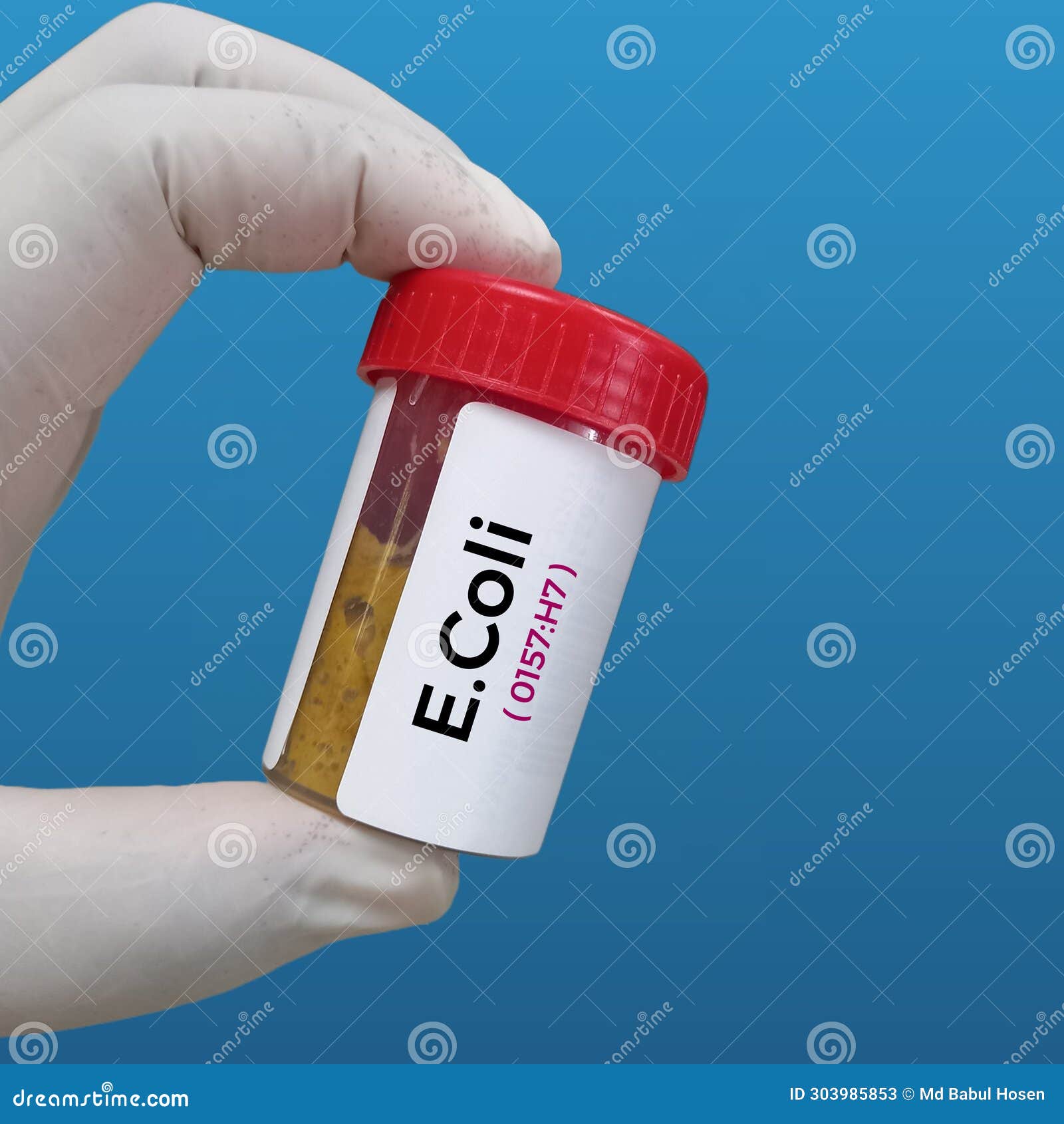 Stool Sample for Escherichia Coli (E. Coli) O157H7 Test Stock Image Stool Sample for Escherichia Coli (E. Coli) O157H7 Test Stock Image