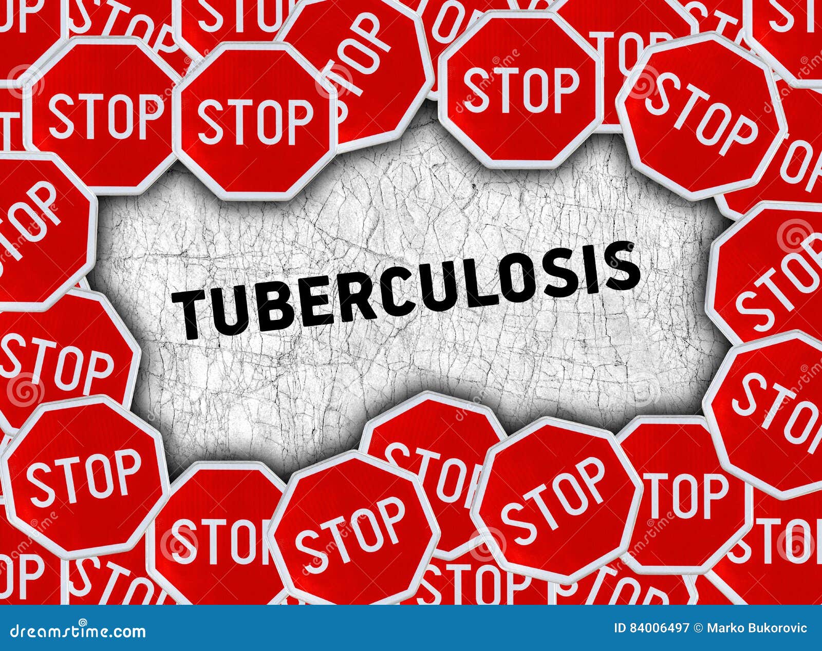 Stop Tuberculosis Disease. Infographics Banner Cartoon Vector