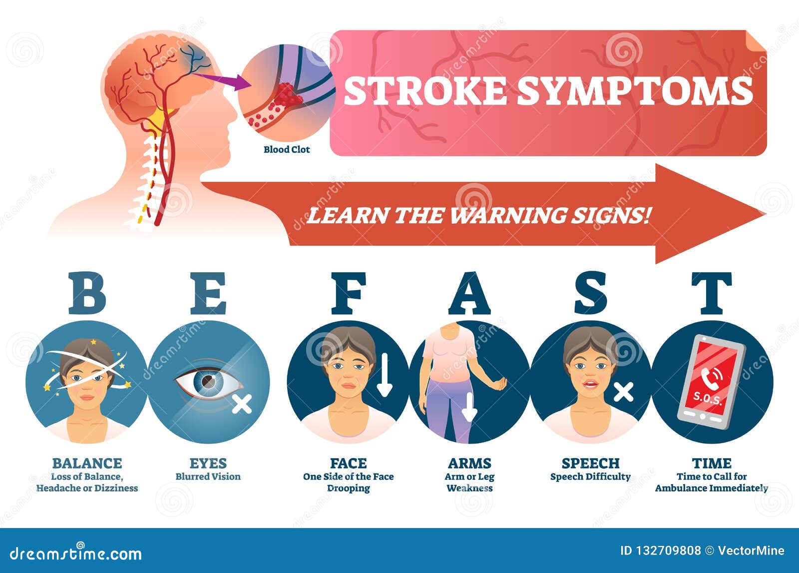 stroke symptoms  . signs of sudden blood clot in head.