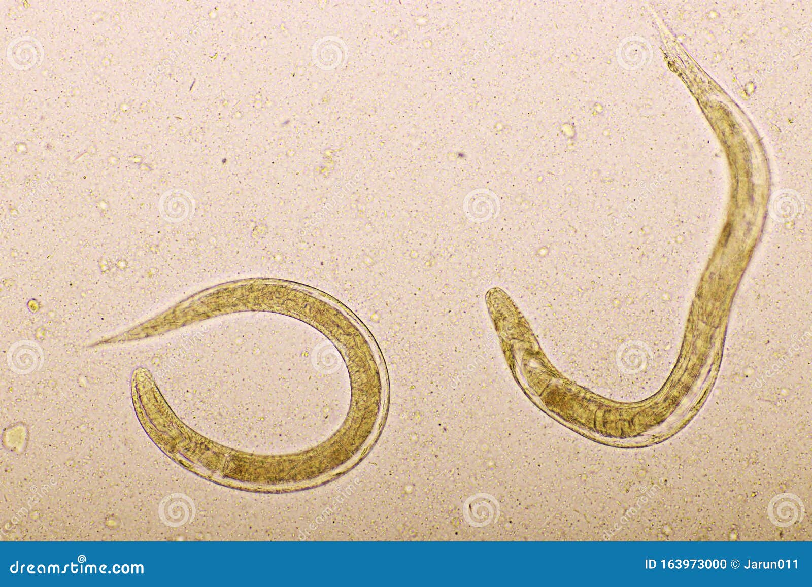 Strongyloides Stercoralis or Threadworm in Human Stool Stock Photo - Image  of analyzing, care: 163973000