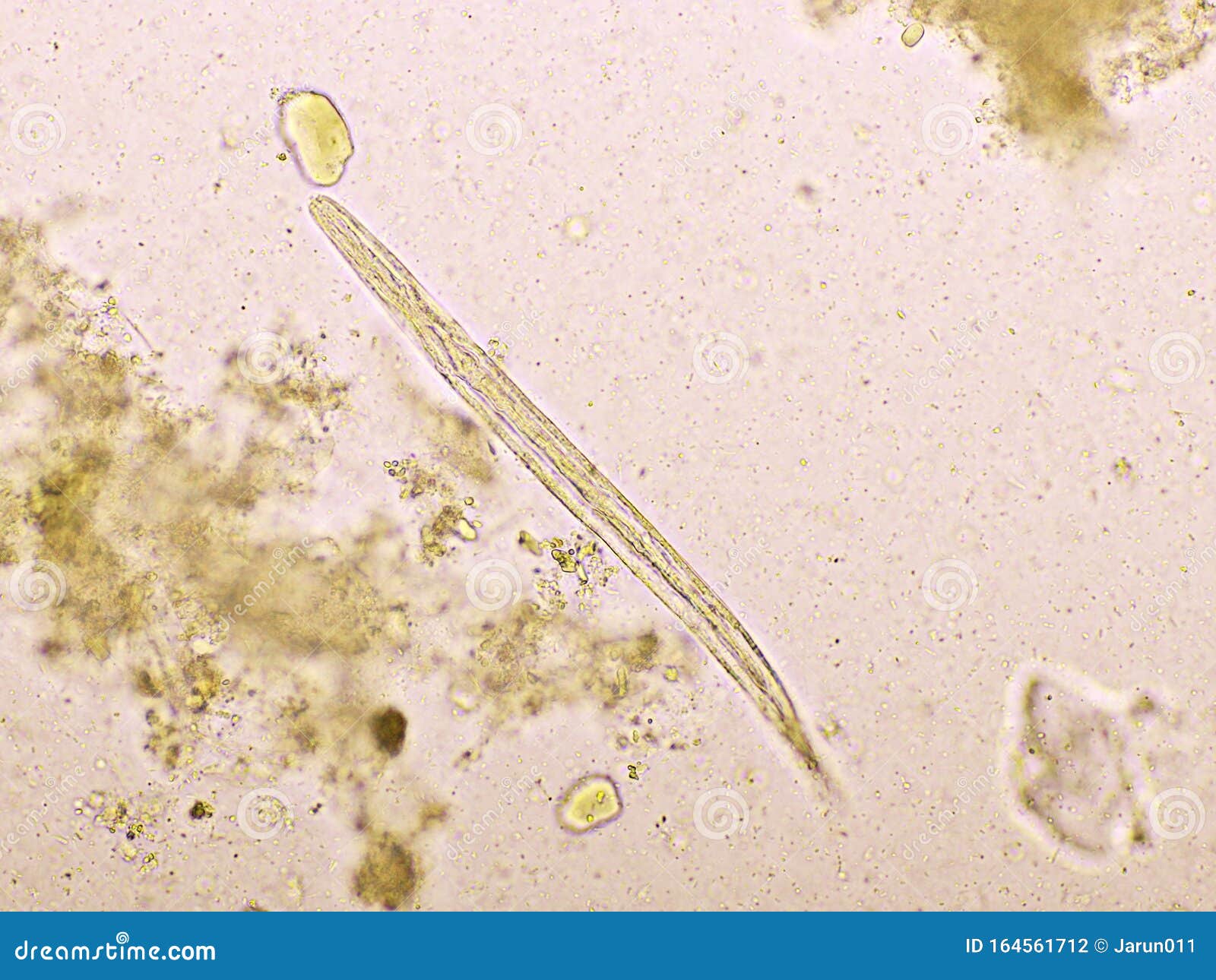 Strongyloides Stercoralis or Threadworm in Human Stool Stock Photo