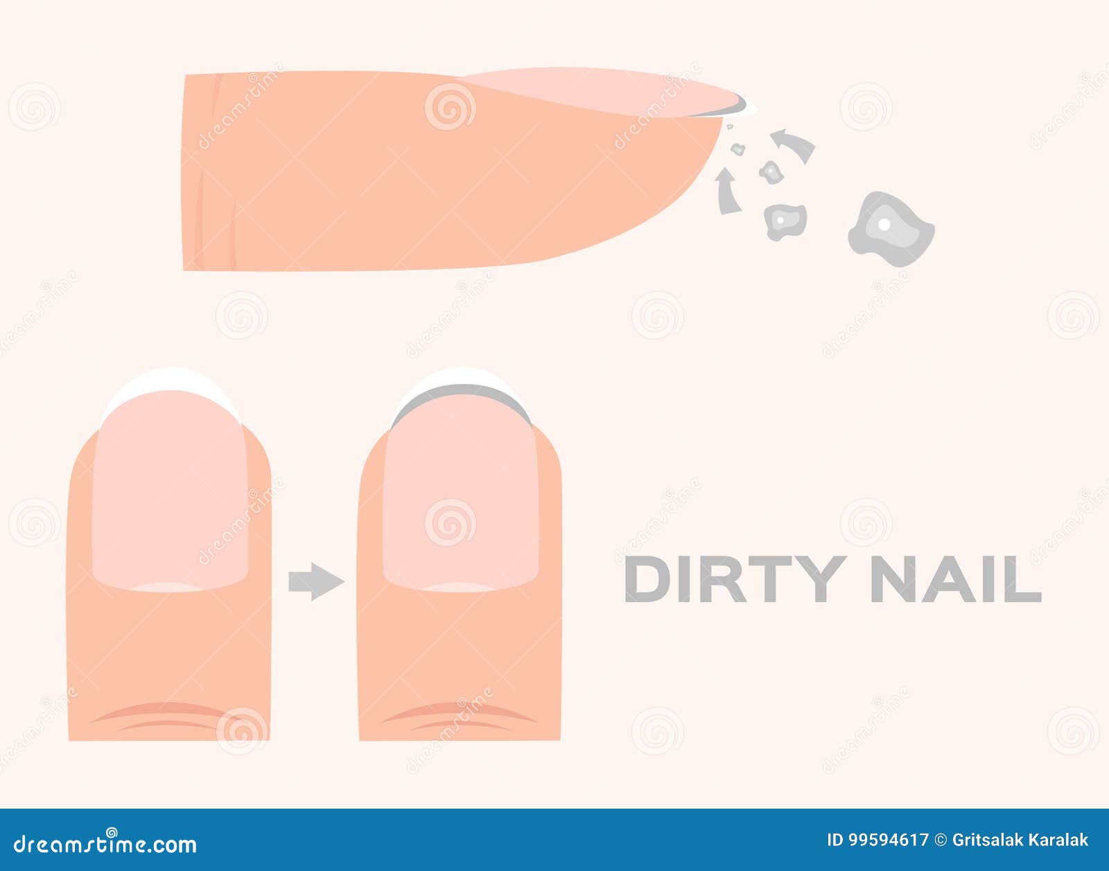 structure of a dirty finger nail . human . anatomy