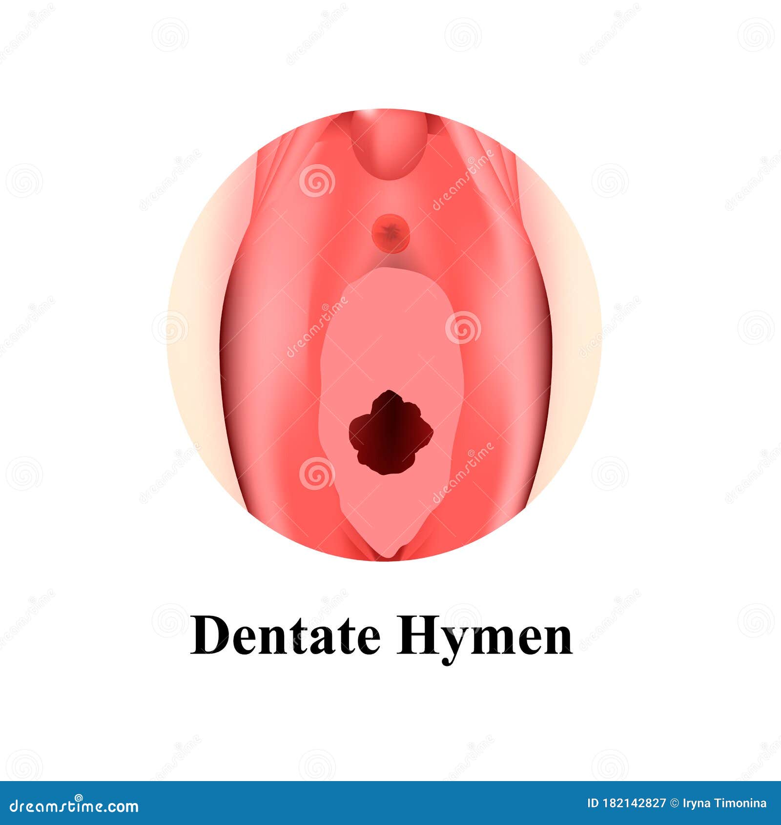 Vulva Hymen Stock Illustrations - 23 Vulva Hymen Stock Illustrations, Vecto...