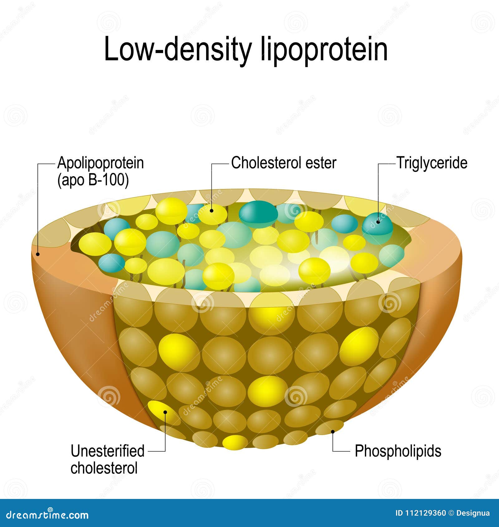 Ldl