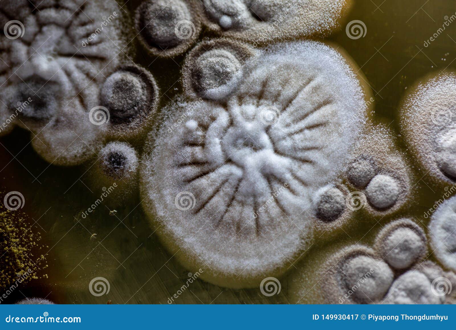 Study Colony Characteristic of Actinomyces, Bacteria, Yeast and Mold on