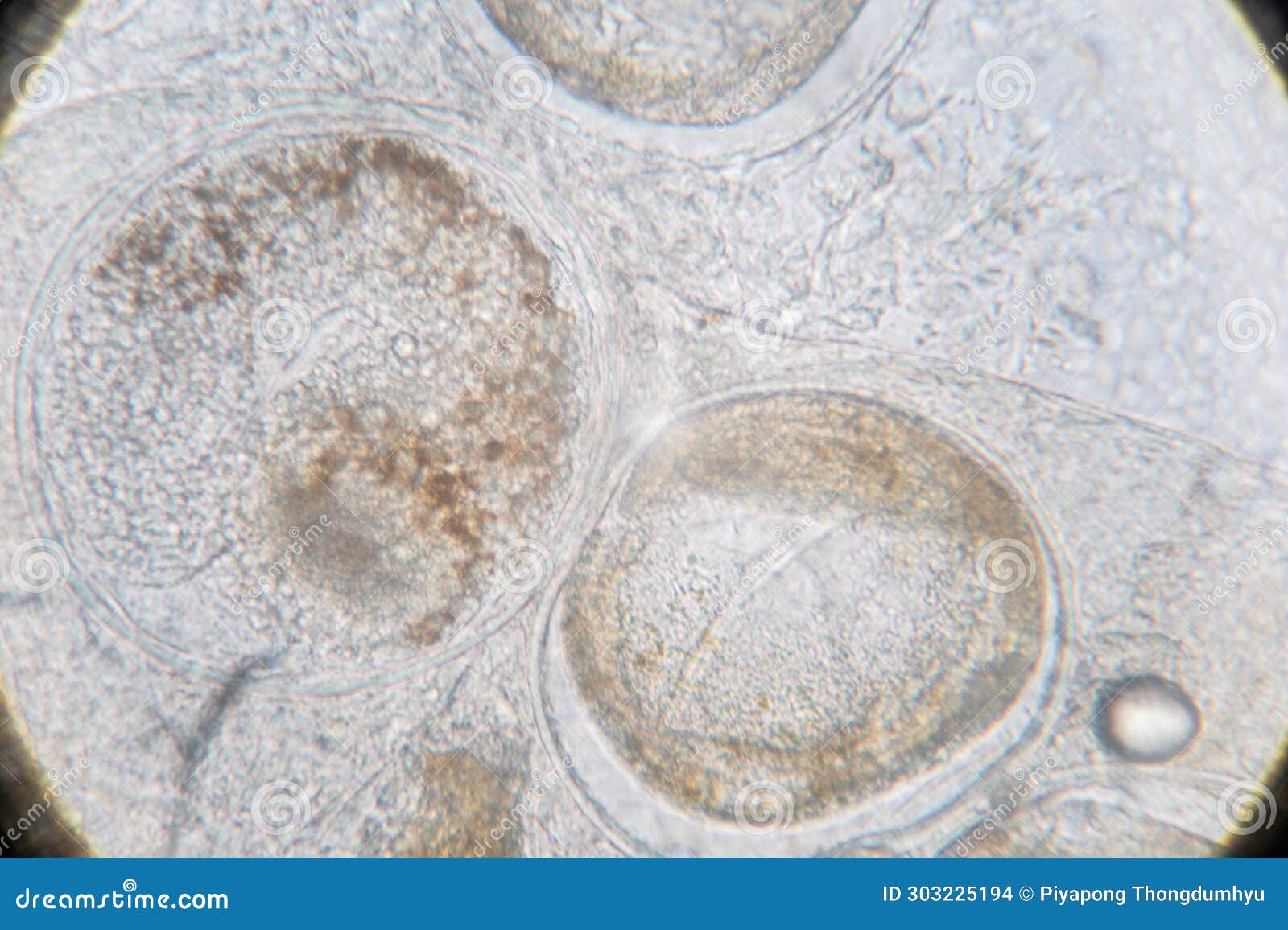 parasitic helminths (trematodes) of marine fishes under a microscope.