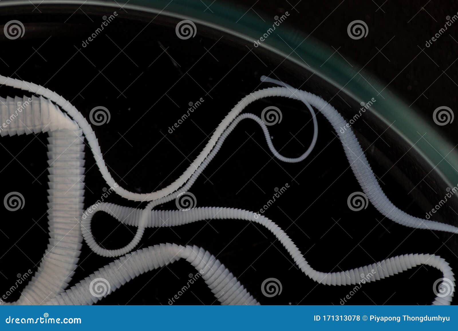 The Study of Tapeworm Infection is Caused by Ingesting Food or Water