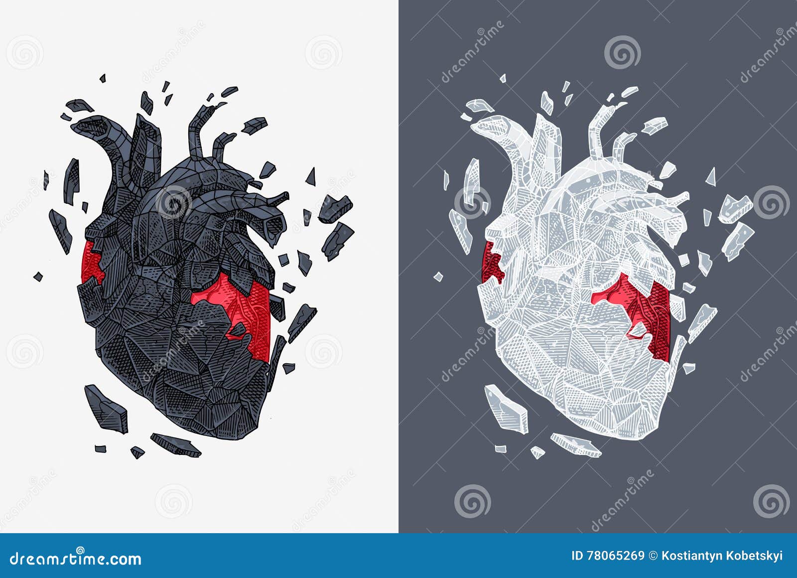 Превращаю сердце в камень. Разбитое сердце Анатомическое. Сердце Анатомическое оазбиток. Расколотое Анатомическое сердце. Разбитое сердце настоящее.