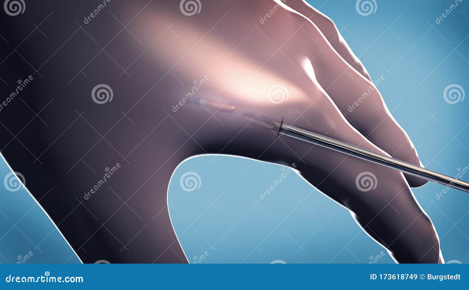 sub dermal microchip implant or transponder implanted into human hand