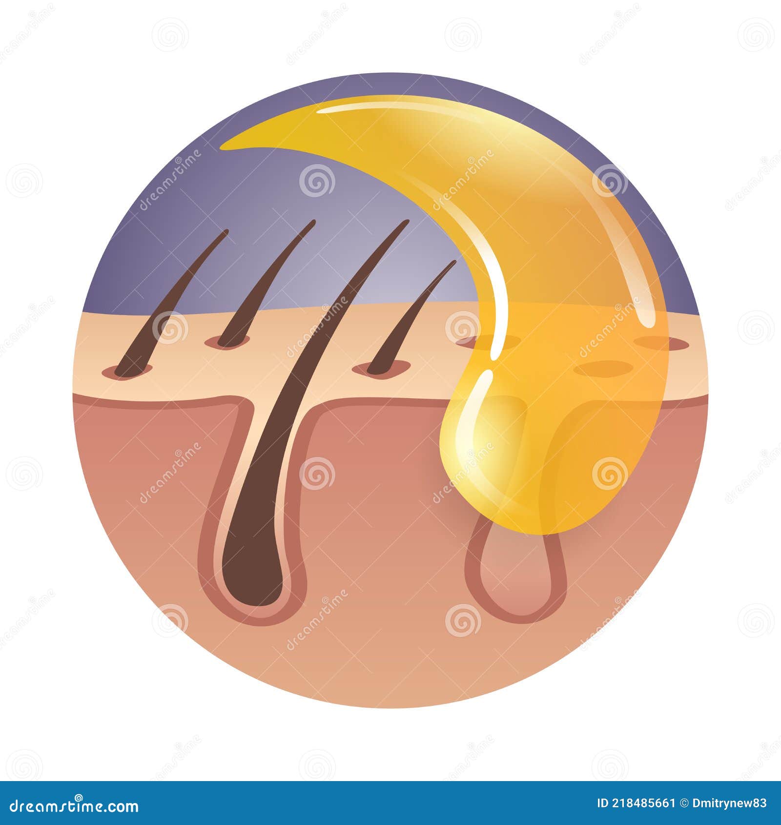 Sugaring - Hair Removal Method Using Hot Wax Stock Vector - Illustration of  dermatology, bikini: 218485661