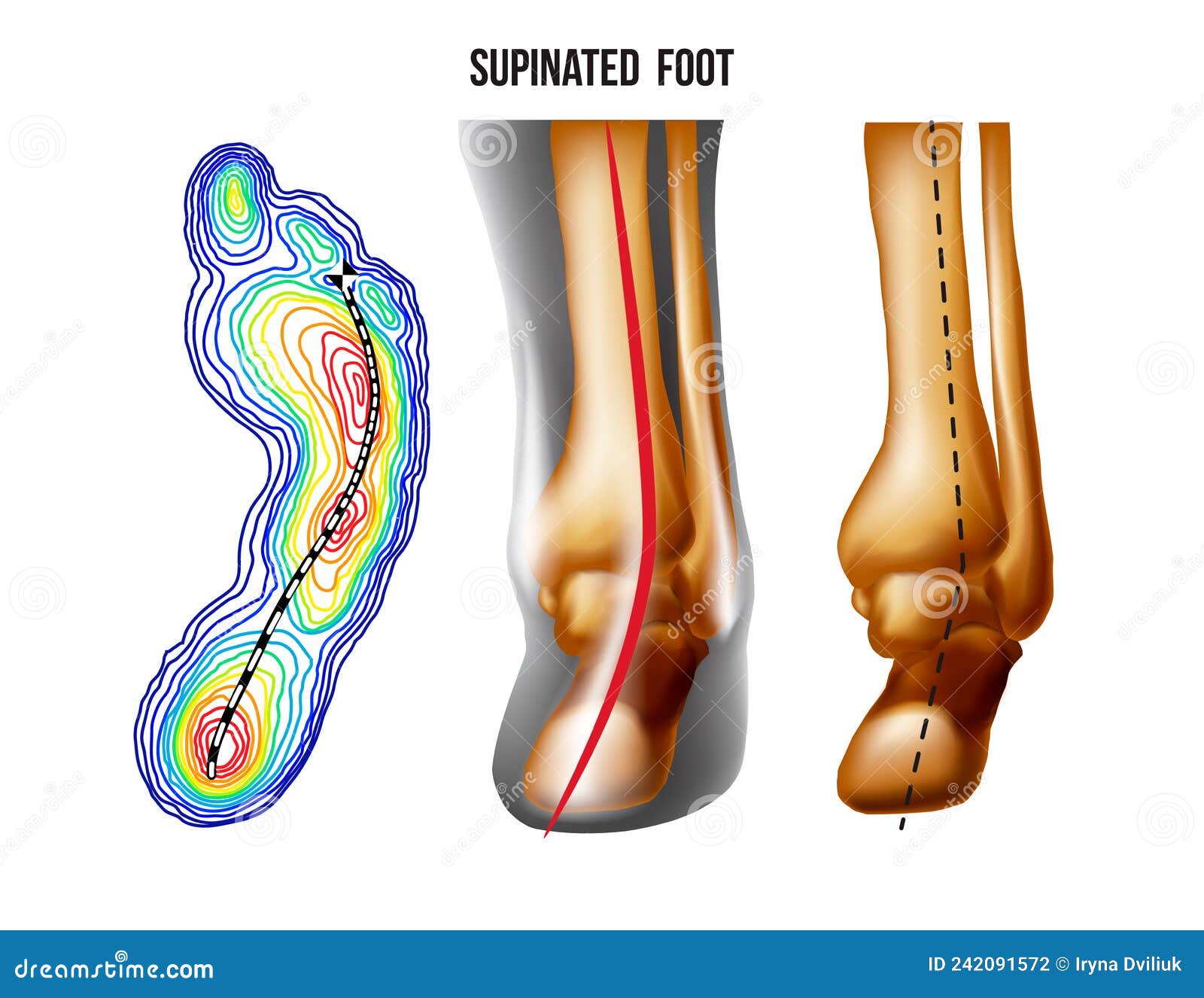 Supination Stock Illustrations – 121 Supination Stock