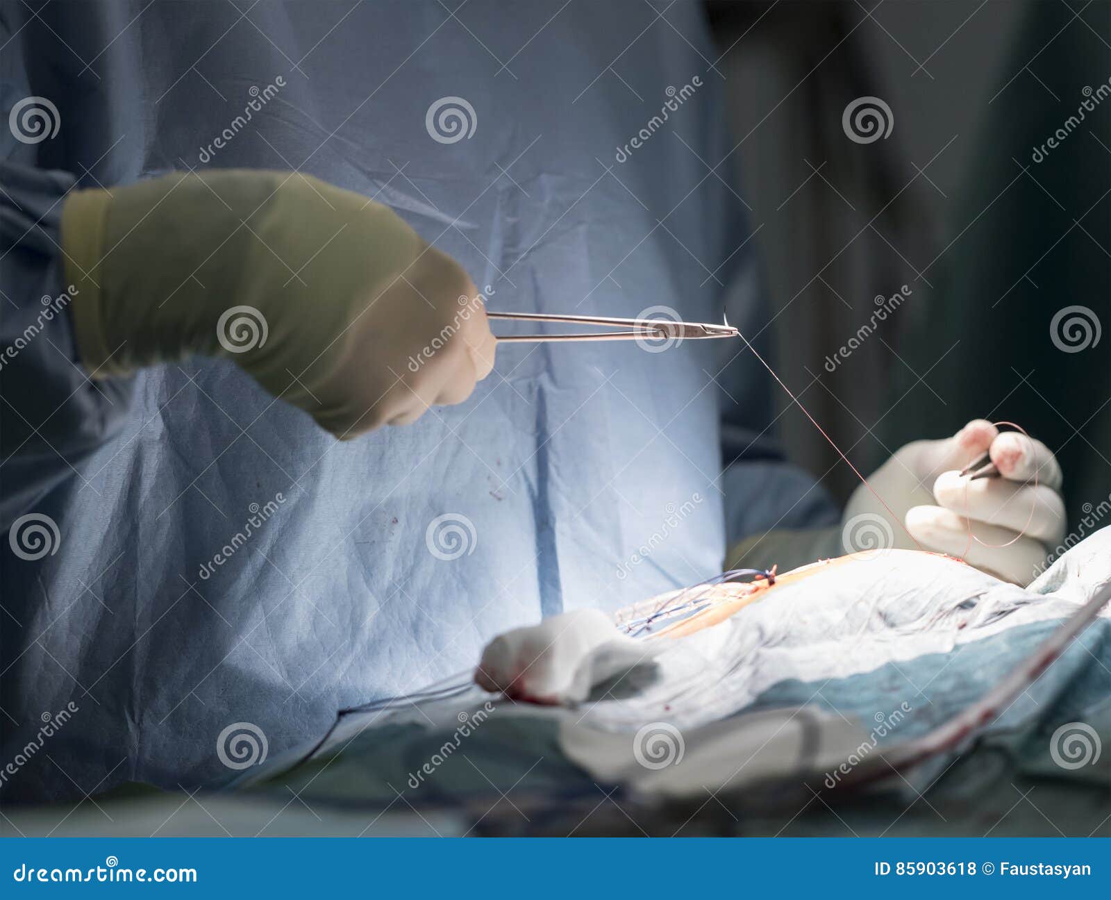 Surgeons in Sterile Gloves Needle Clamp Sutured Wound Stock Photo