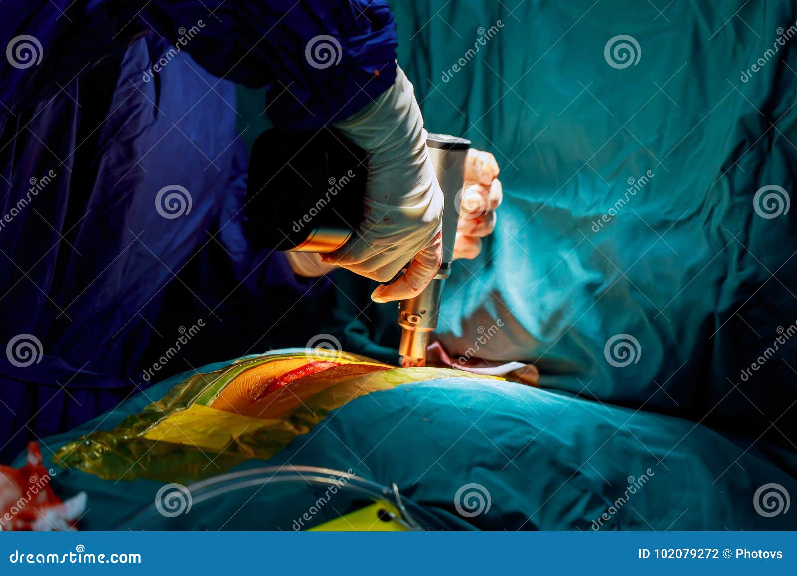 Surgical Cutting of the Human Chest Macro Stock Photo Image of