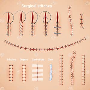 Surgical Cartoons Illustrations Vector Stock Images 7344 Pictures 