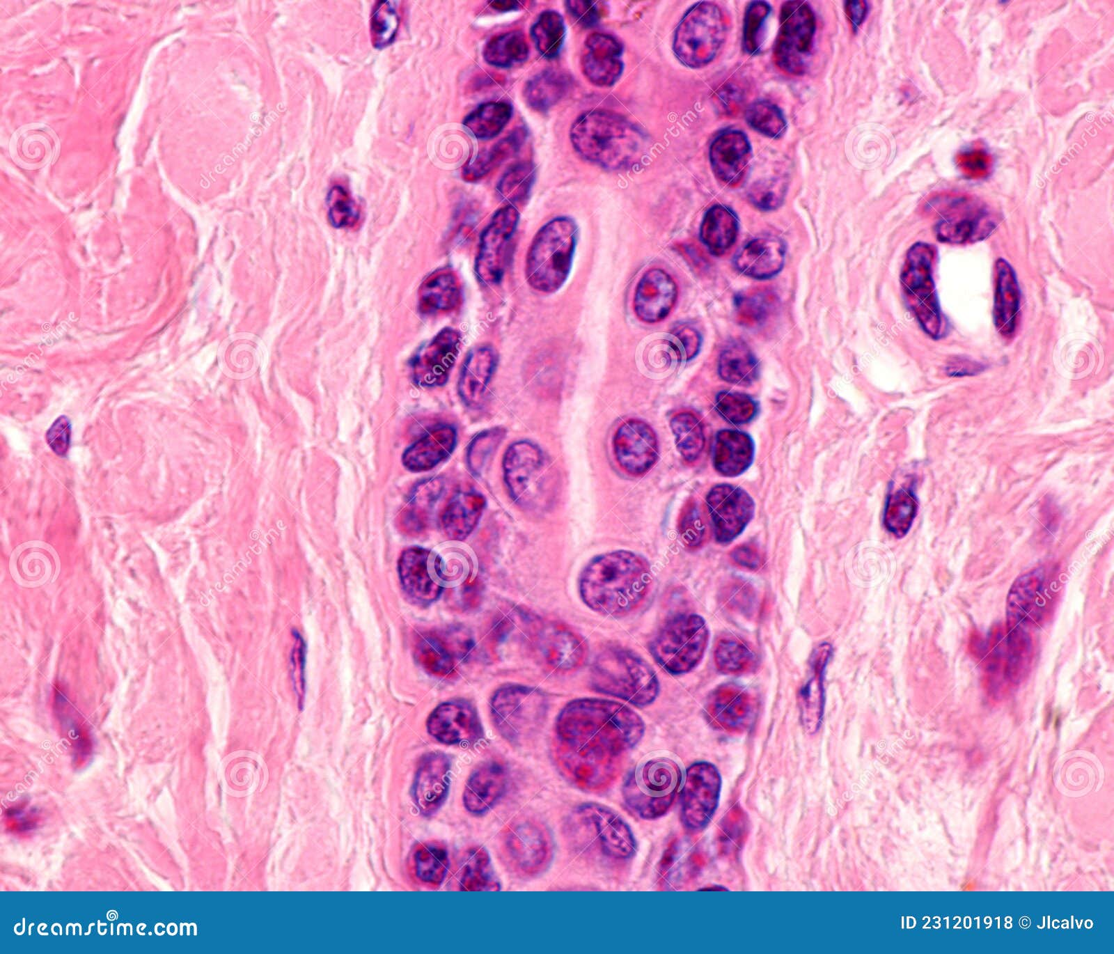 Sweat Gland Intradermal Duct Stock Photo Image Of Dermis Human