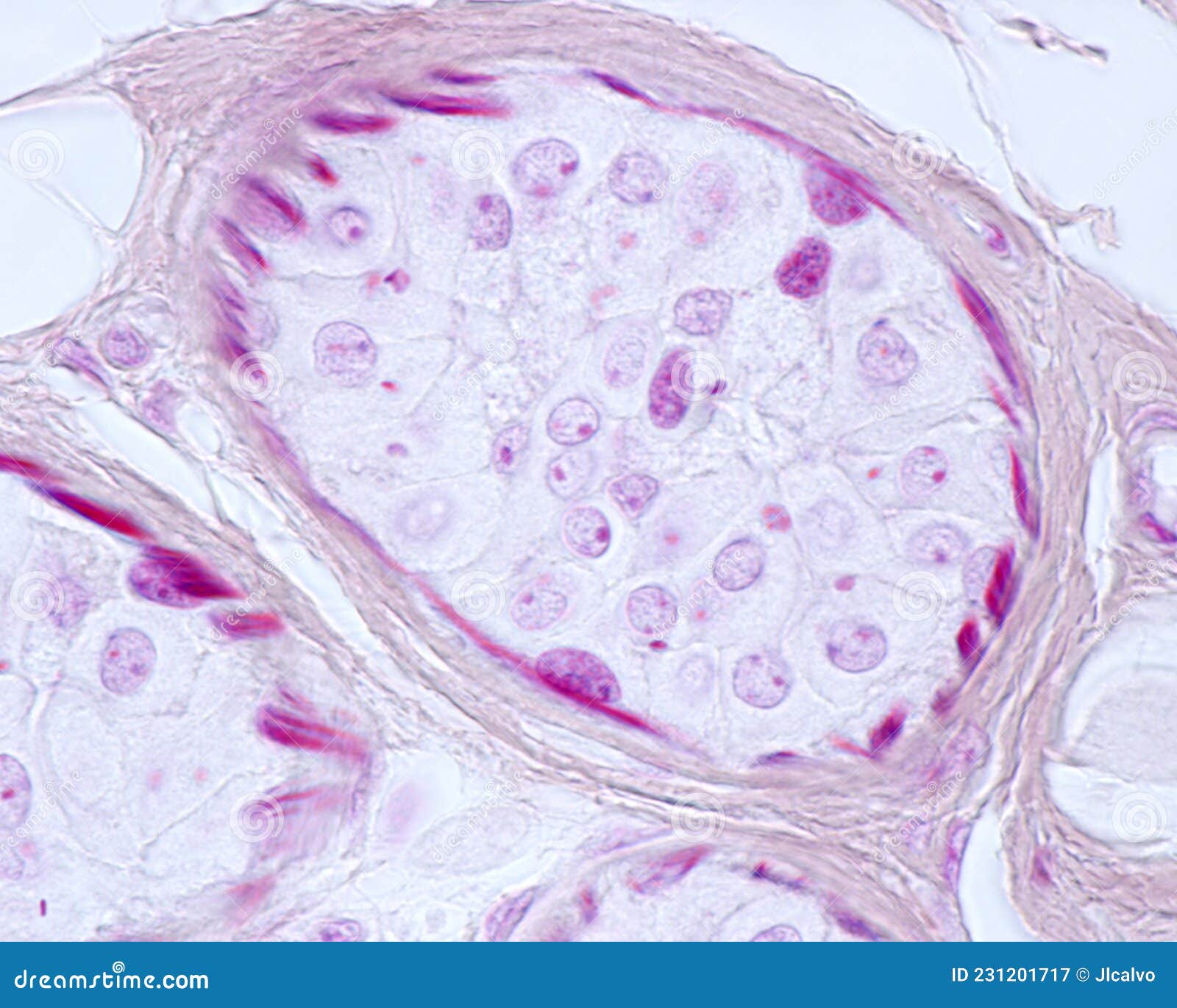Eccrine Sweat Gland Myoepithelial Cells Stock Image Image Of