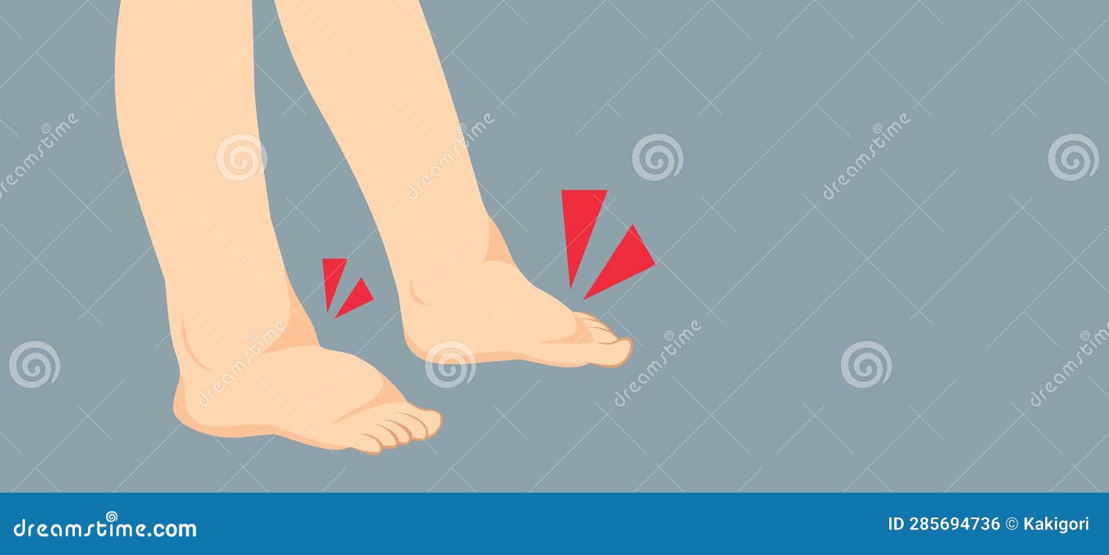 Swelling Feet or Kidney Problems Illustration Stock Illustration