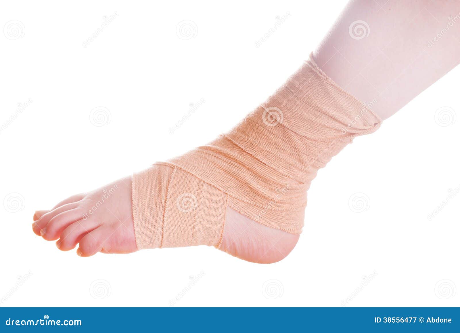 Swollen Injured Male Limb On The Left Foot With Hematoma When A Heavy