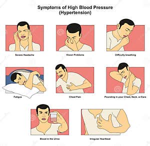 Chest Pain Common Causes Infographic Diagram Stock Vector 51 OFF