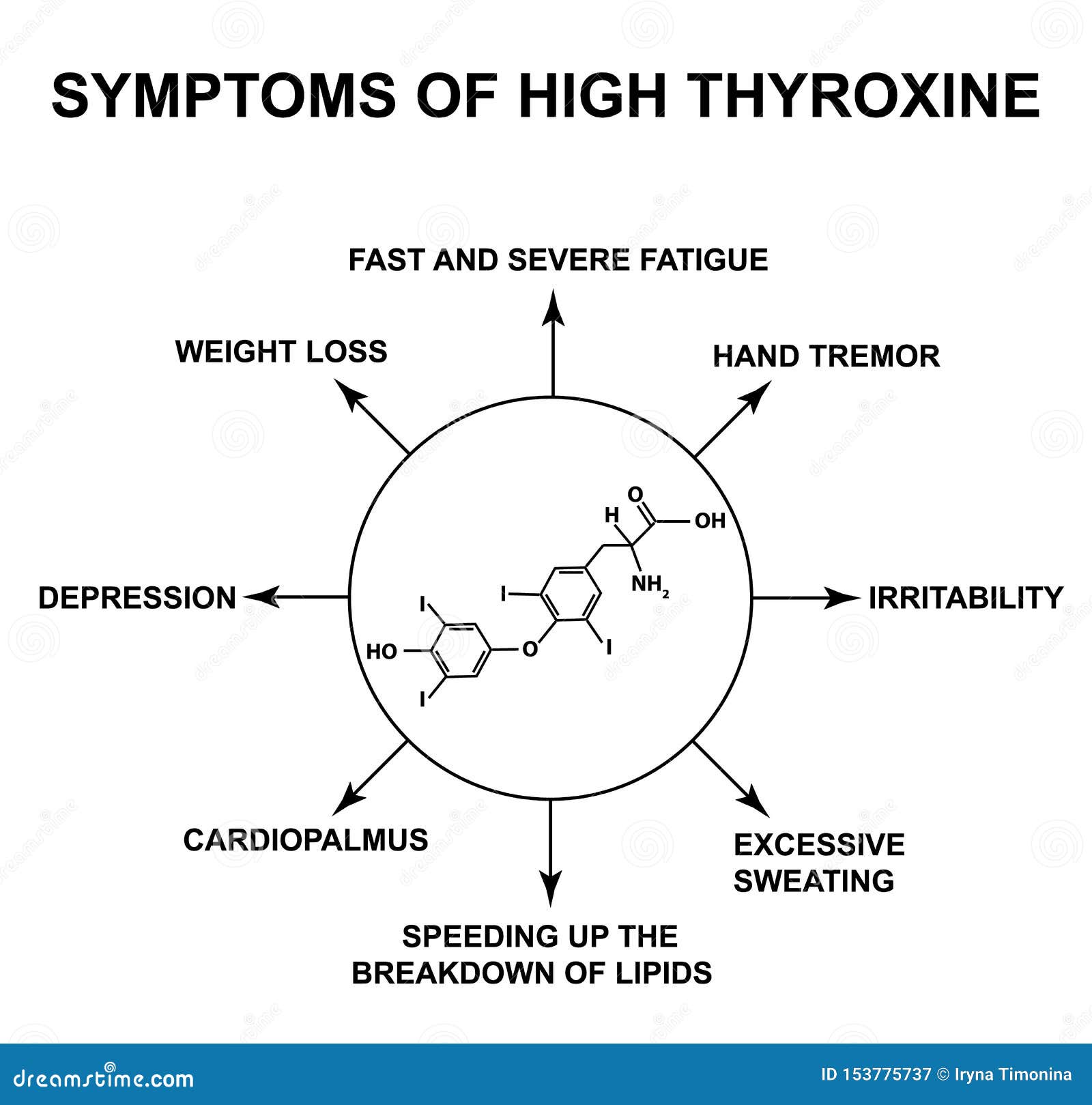 Symptoms of High Thyroxine. Thyroxine Thyroid Hormone. Infographics