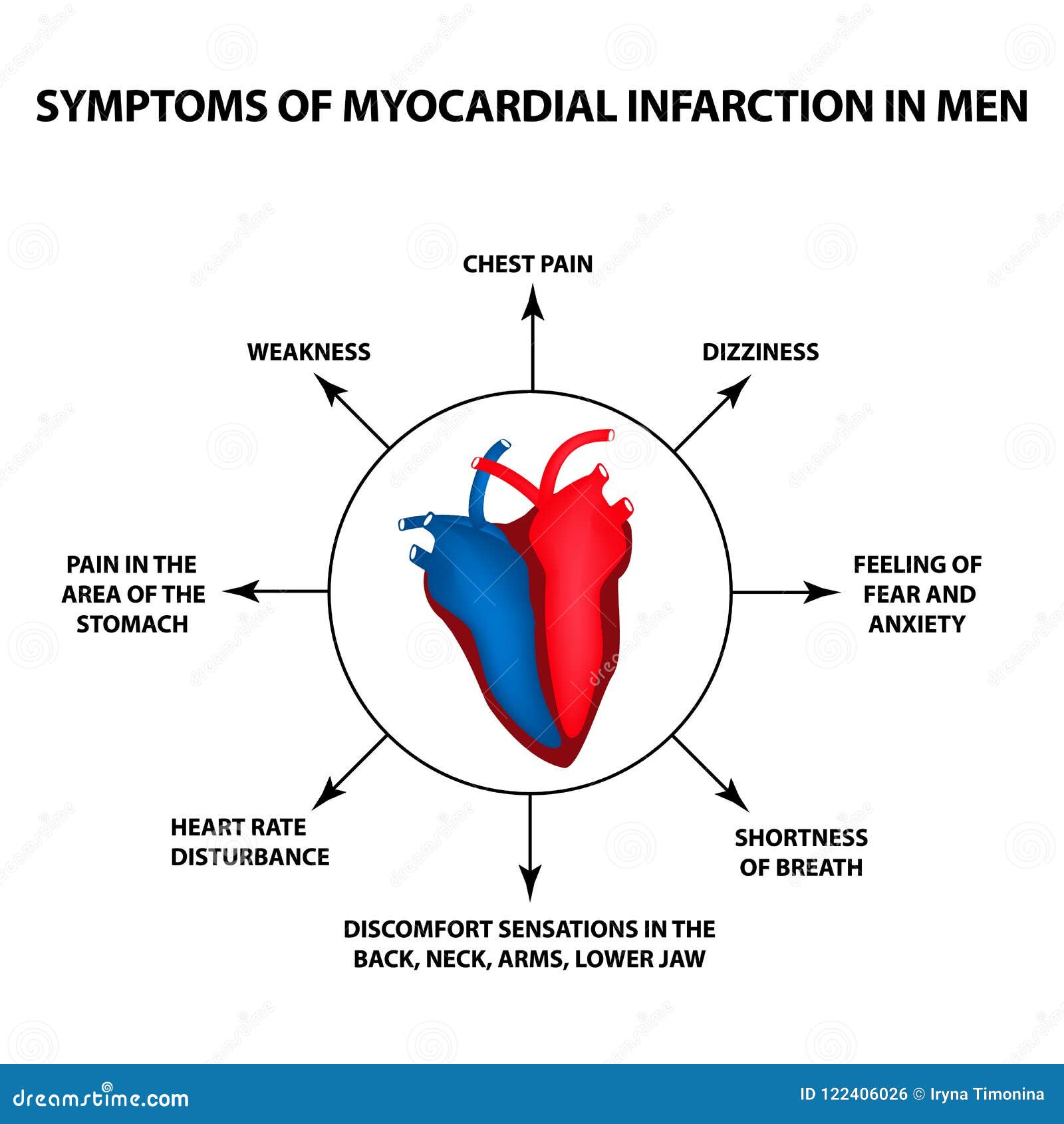 Myocardial Infarction Symptoms myocardial-infarction-symptoms