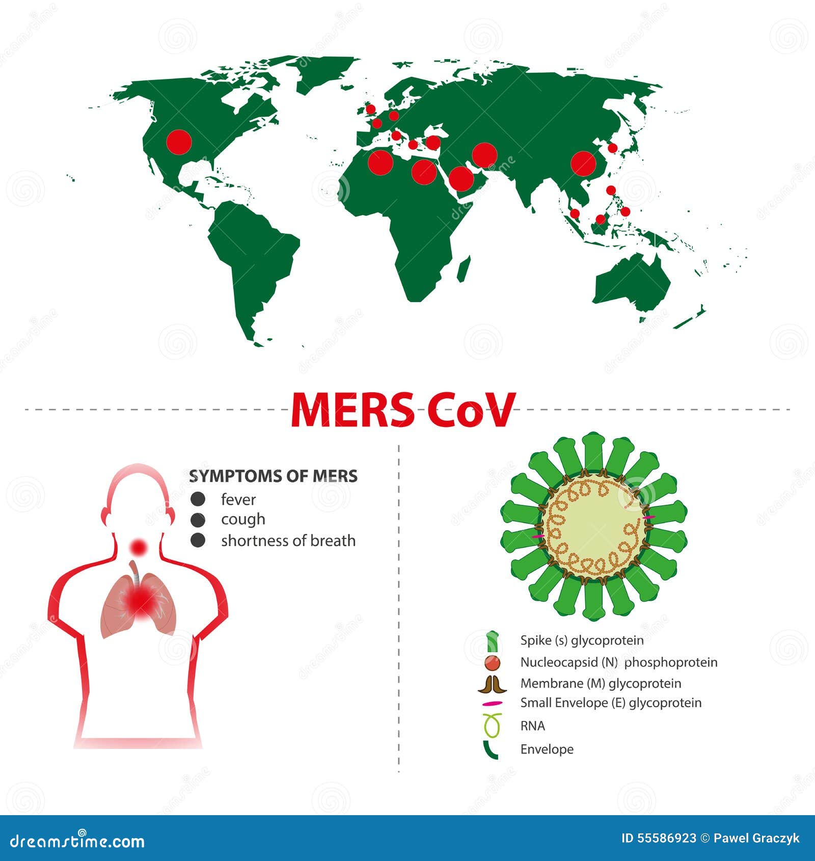 Syndrome of mers stock vector. Illustration of mers, infection - 555869231300 x 1390