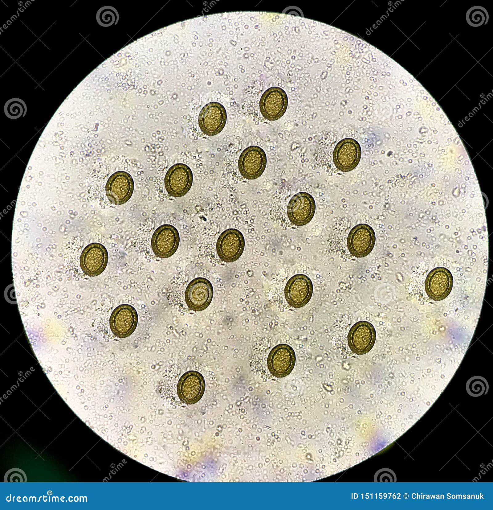 parasite eggs in stool