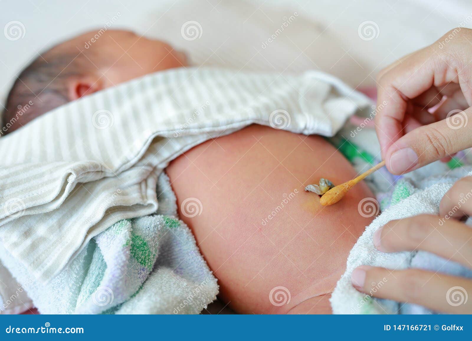 Tampon De Coton D Utilisation De Mere Humidifie De L Alcool Pour Essuyer Pour Nettoyer Le Bebe De Cordon Ombilical De Nombril Nou Image Stock Image Du Treatment Tige Tampon De Coton D Utilisation De Mere Humidifie De L Alcool Pour Essuyer Pour Nettoyer Le Bebe De Cordon Ombilical De Nombril Nou Image Stock Image Du Treatment Tige