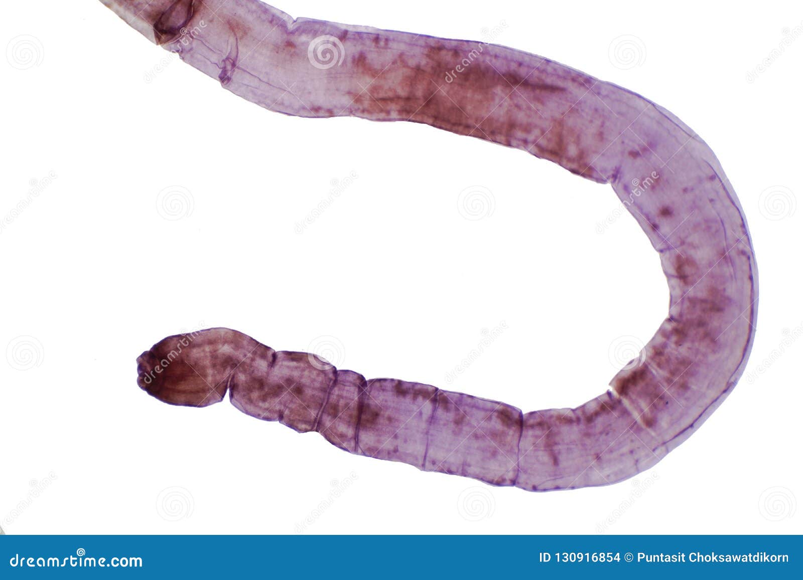 Tapeworm Parasitic Flatworm of Cattle and Other Grazing Animal Stock Photo - Image of infection, eggs: 130916854 Tapeworm Parasitic Flatworm of Cattle and Other Grazing Animal Stock Photo - Image of infection, eggs: 130916854