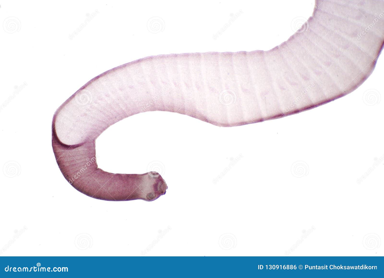 Tapeworm Parasitic Flatworm of Cattle and Other Grazing Animal Stock Photo  - Image of beef, hygiene: 130916886