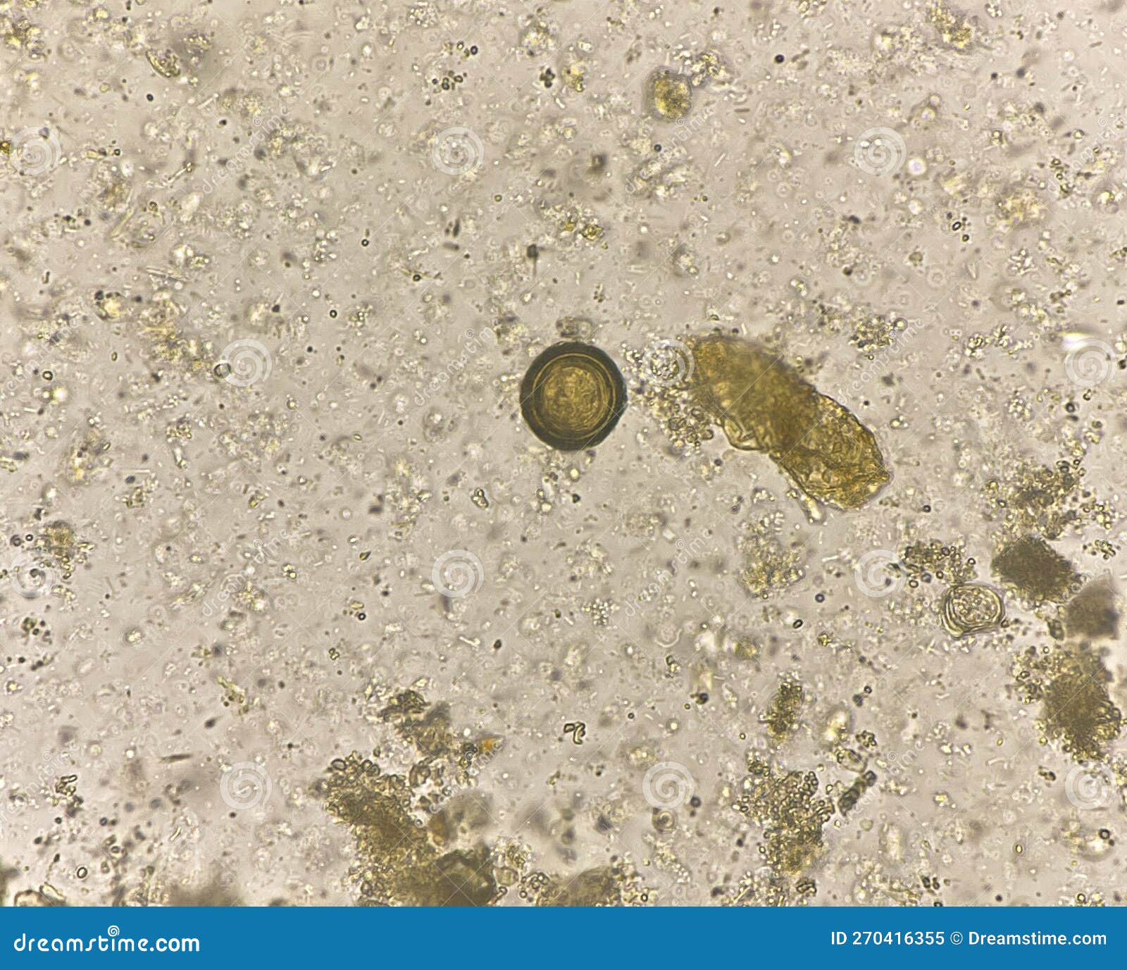 Teania Egg Human Parasite in Stool Stock Image Image of ascariasis