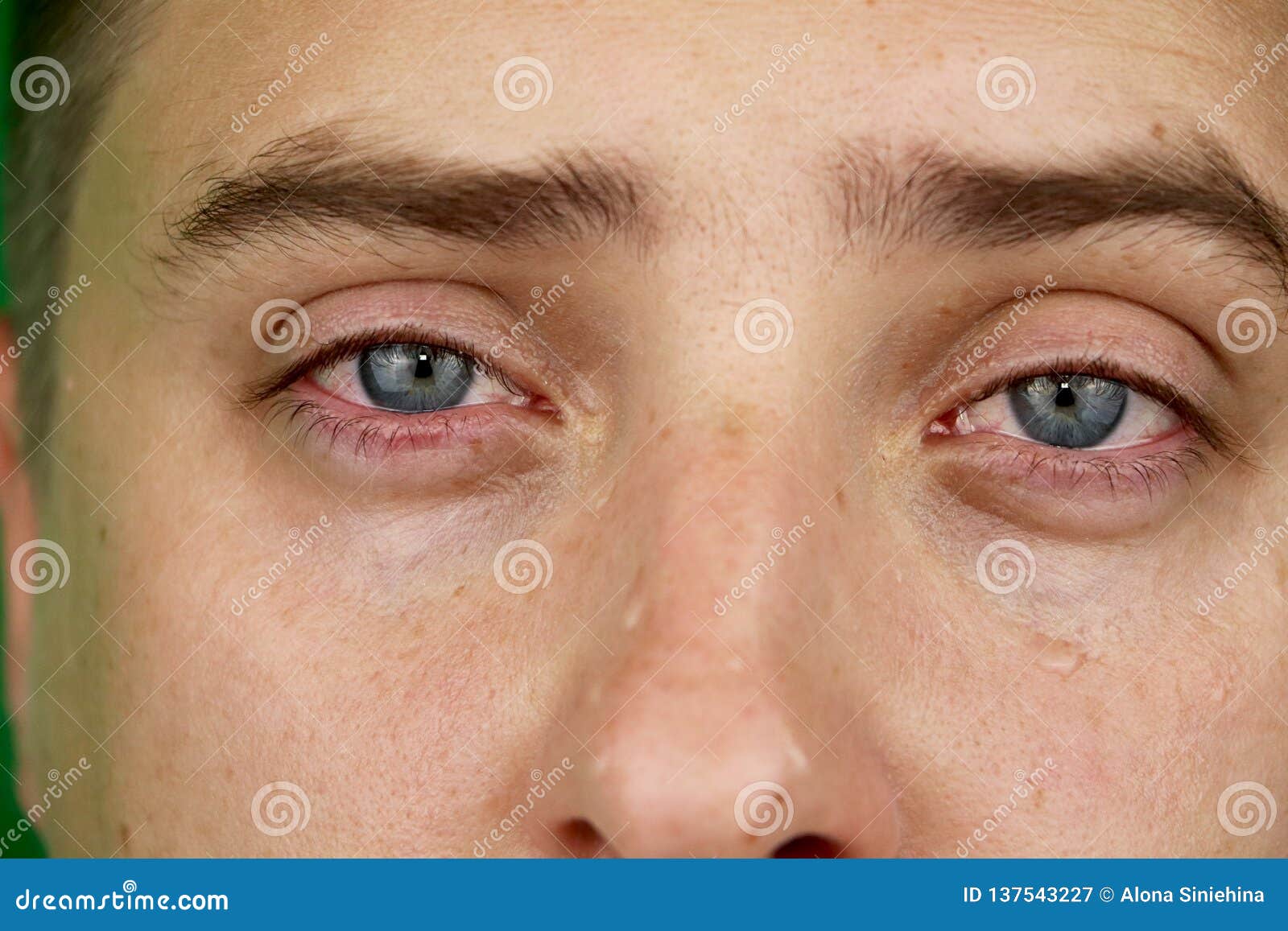 Tears in Eyes of Crying Adult Man. Green Background Stock Image ...