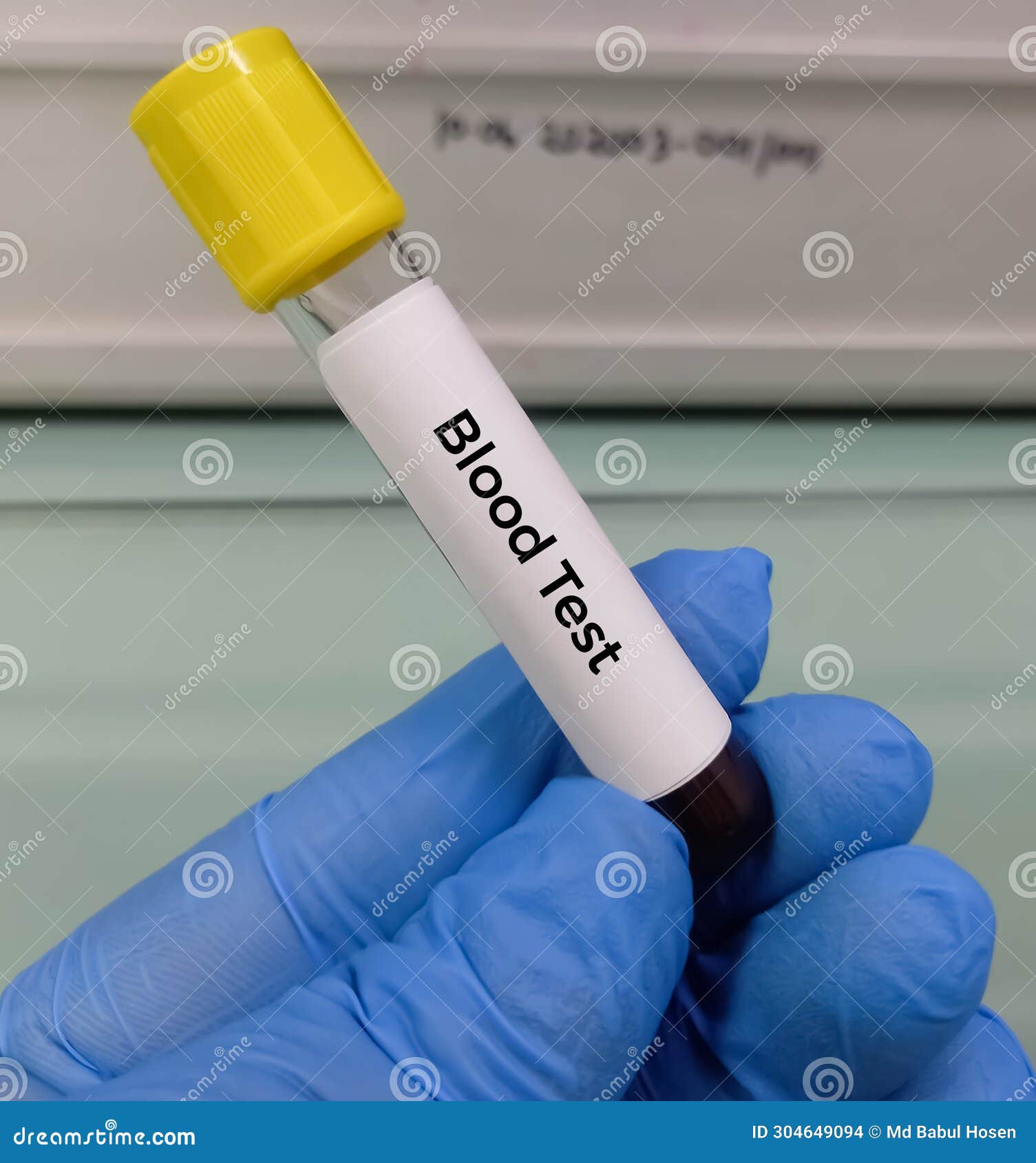 Technician Holding Test Tube with Blood Sample for Medical Testing
