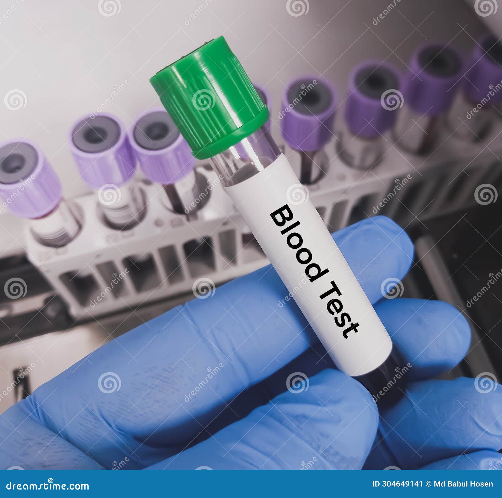Technician Holding Test Tube with Blood Sample for Medical Testing