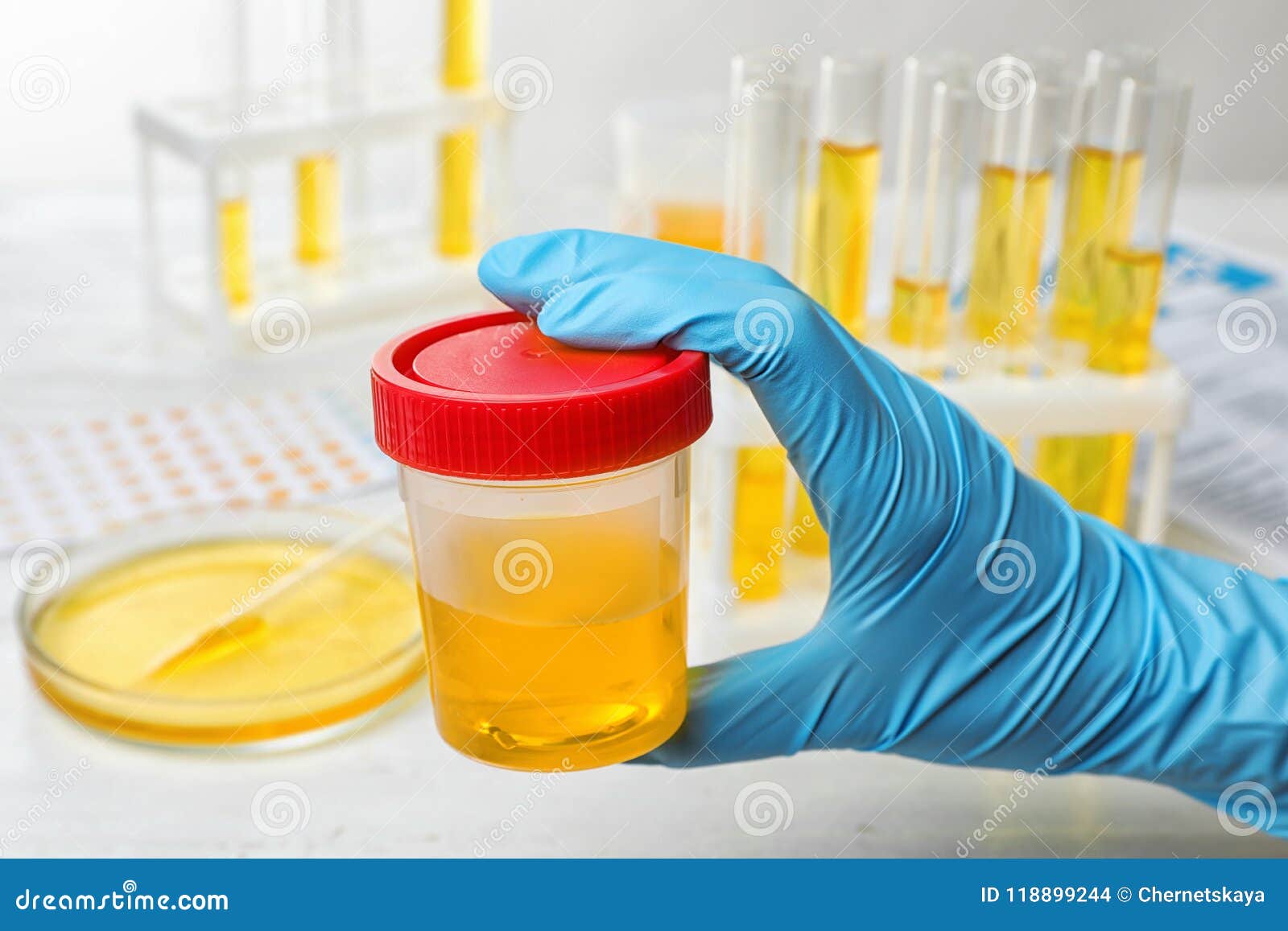 le technicien tient un échantillon d'urine pour le test de