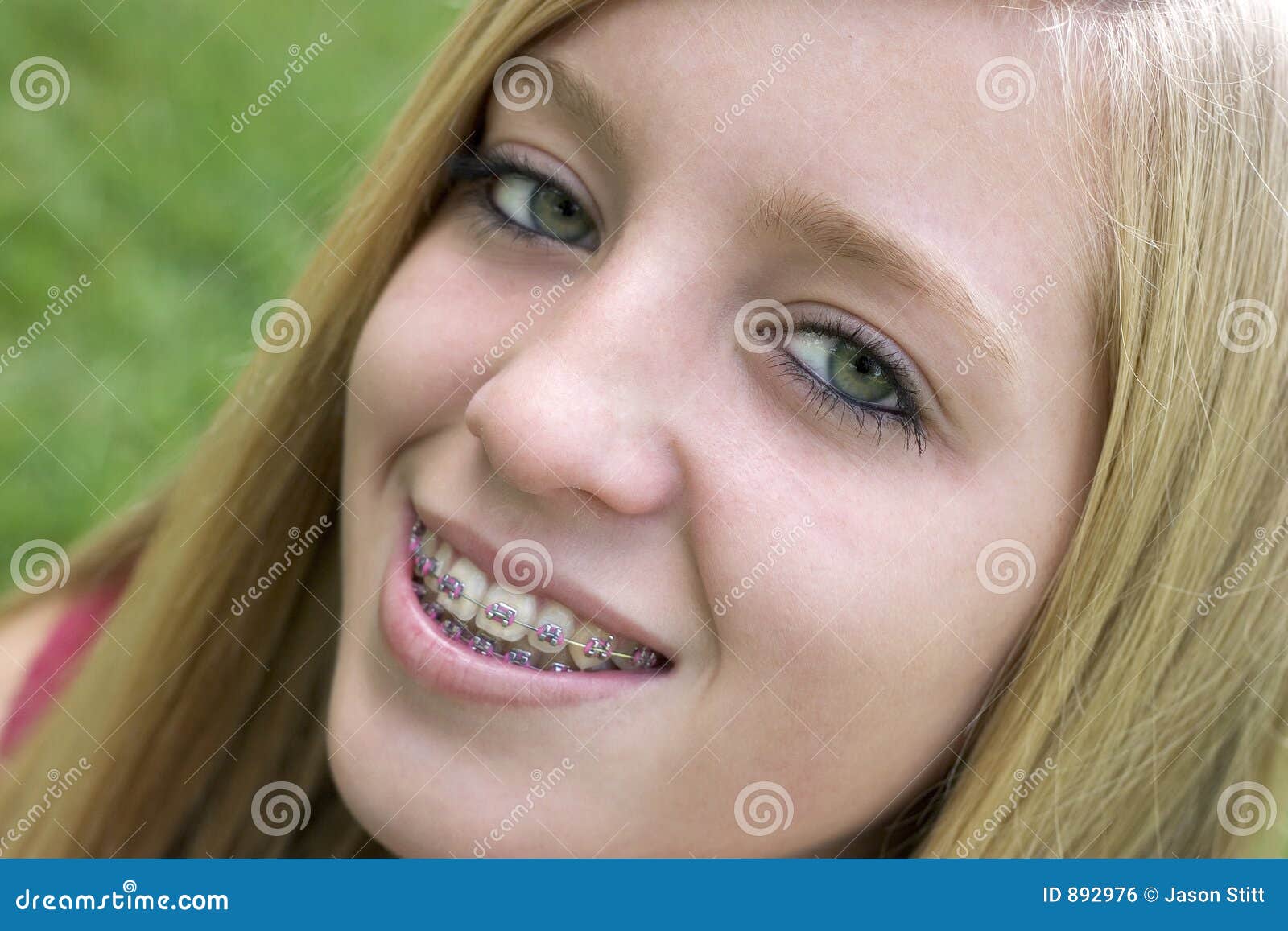 Hot Teen Girls With Braces