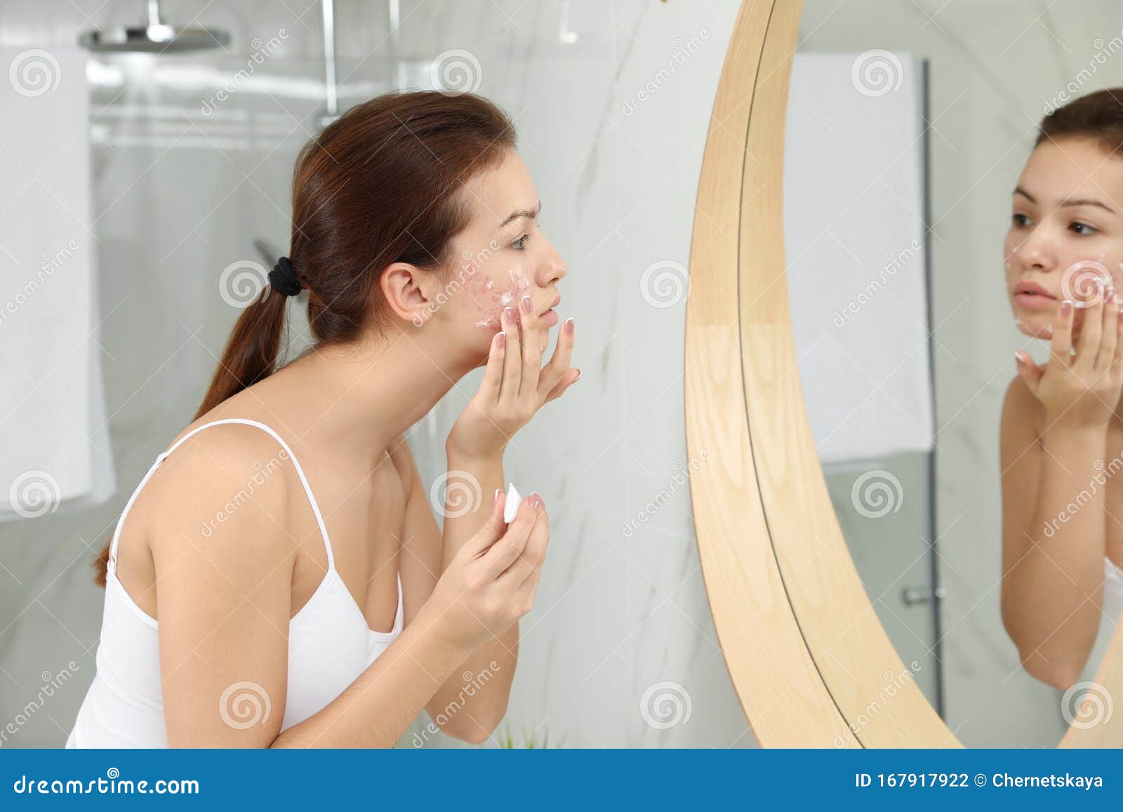 Teen Girl With Acne Problem Applying Cream Near Mirror ...