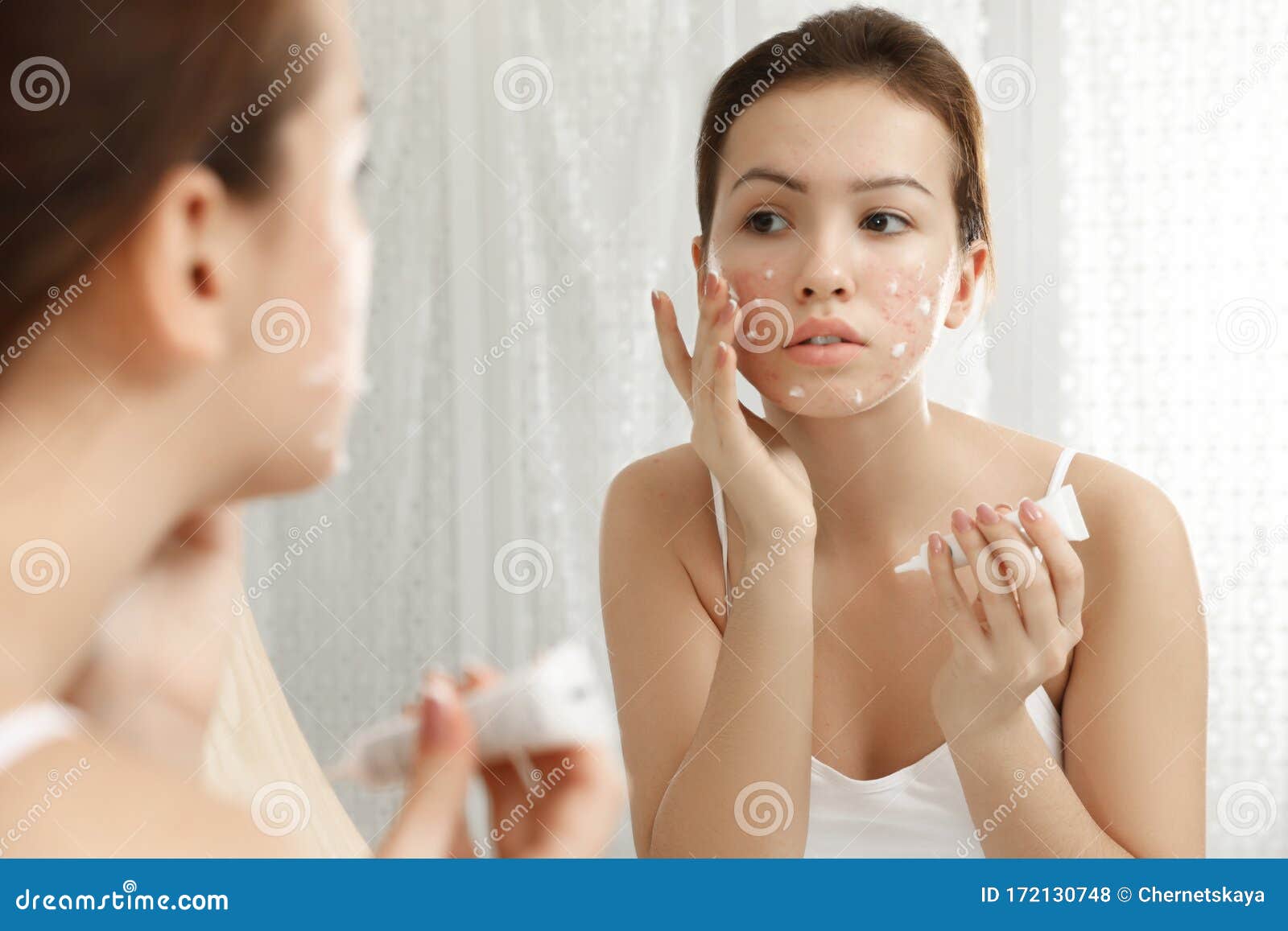 Young Woman in White Underwear Applies Ointment for the Rash To the Elbows.  Treatment of Dermatological Diseases Stock Image - Image of body,  dermatological: 241384777