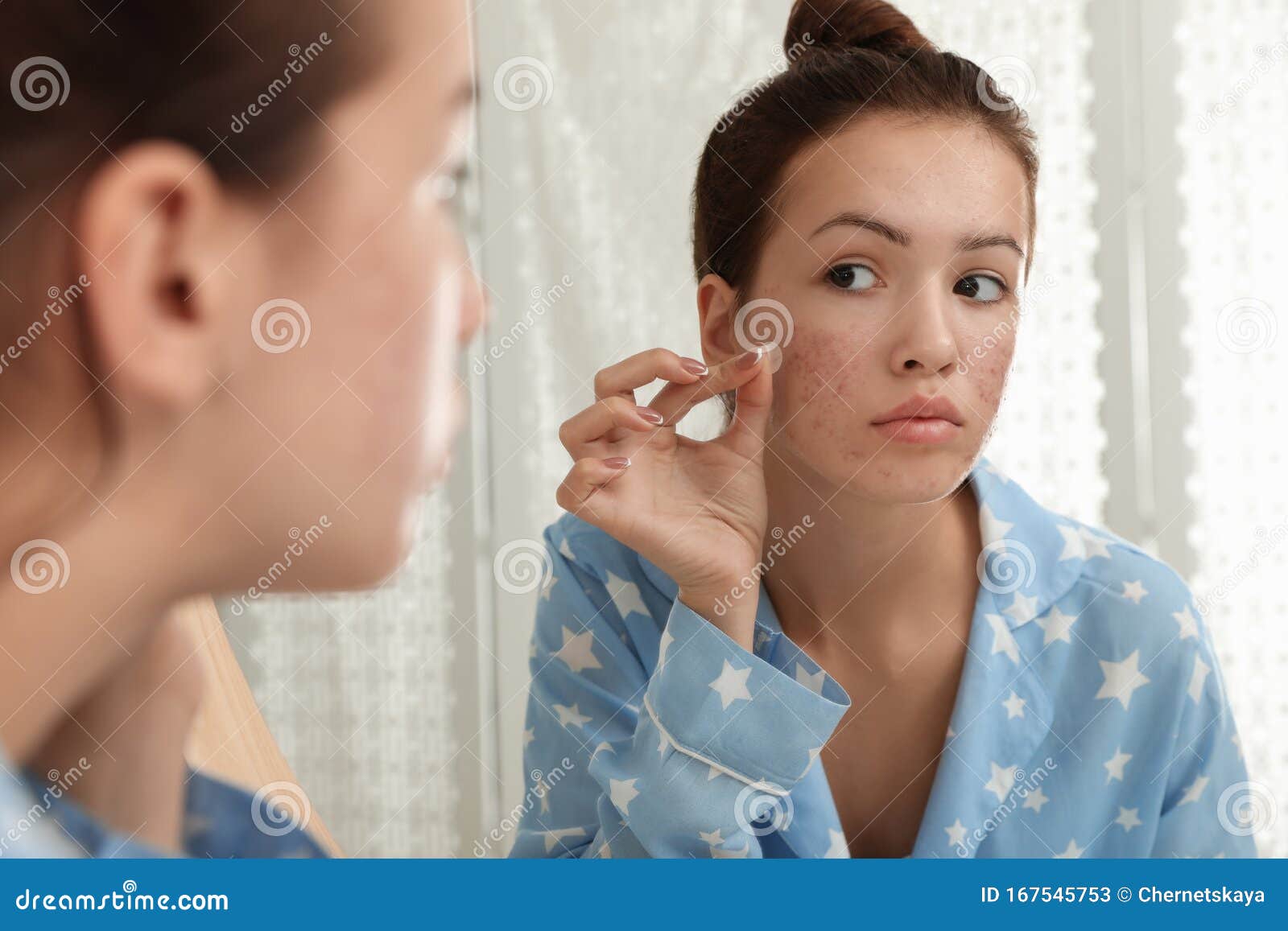 teen girl applying acne healing patch near mirror
