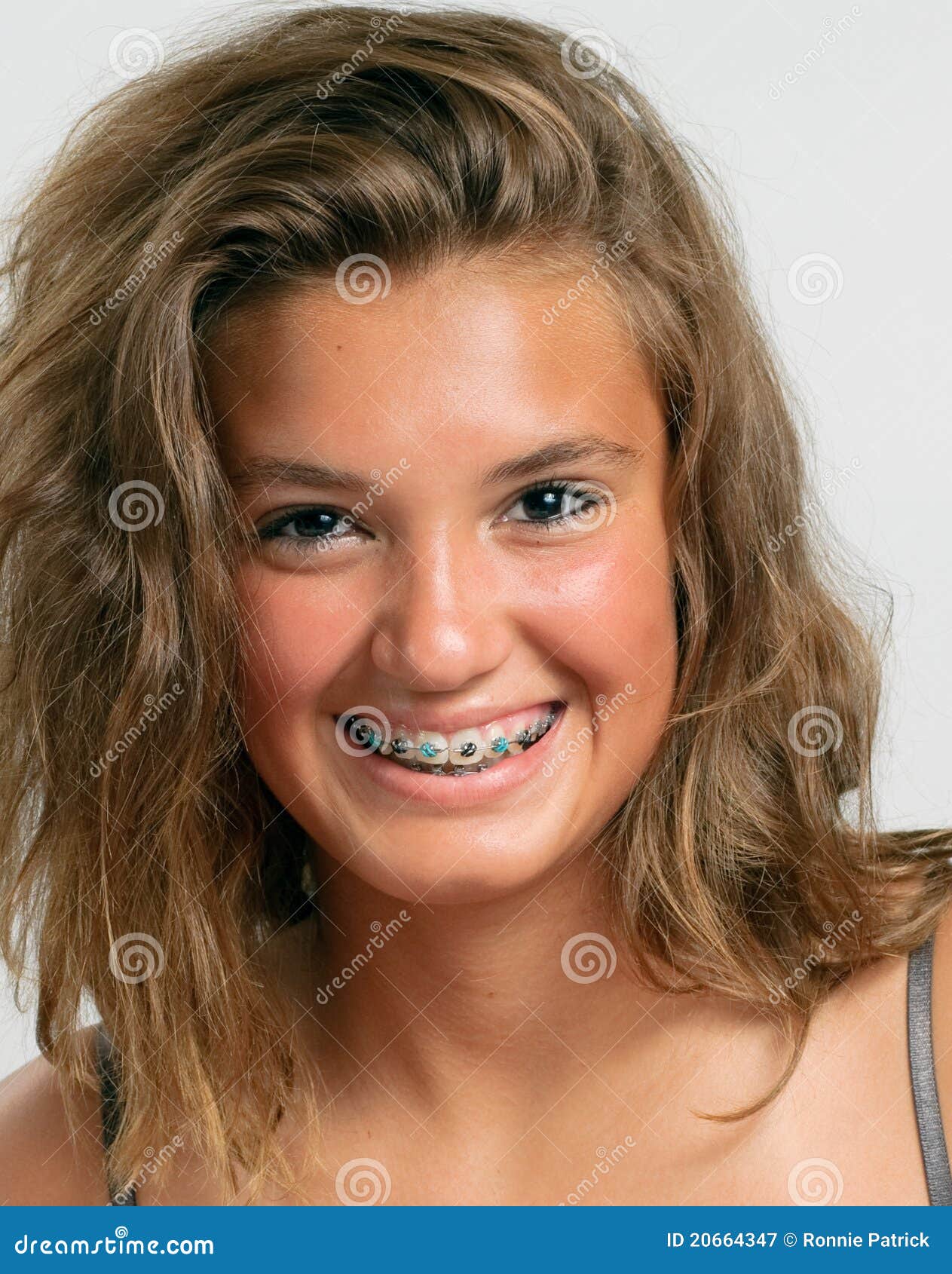 Teen Girl With Blue Braces Royalty Free Stock Photogr