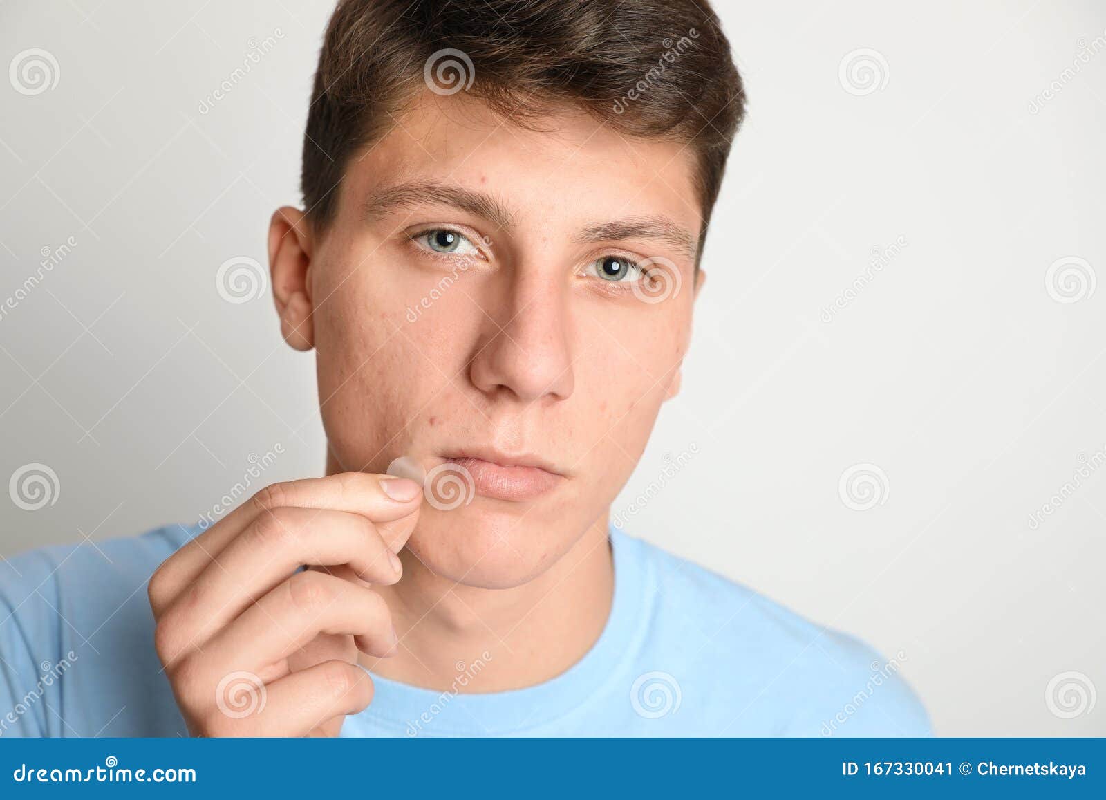 teen guy applying acne healing patch on background