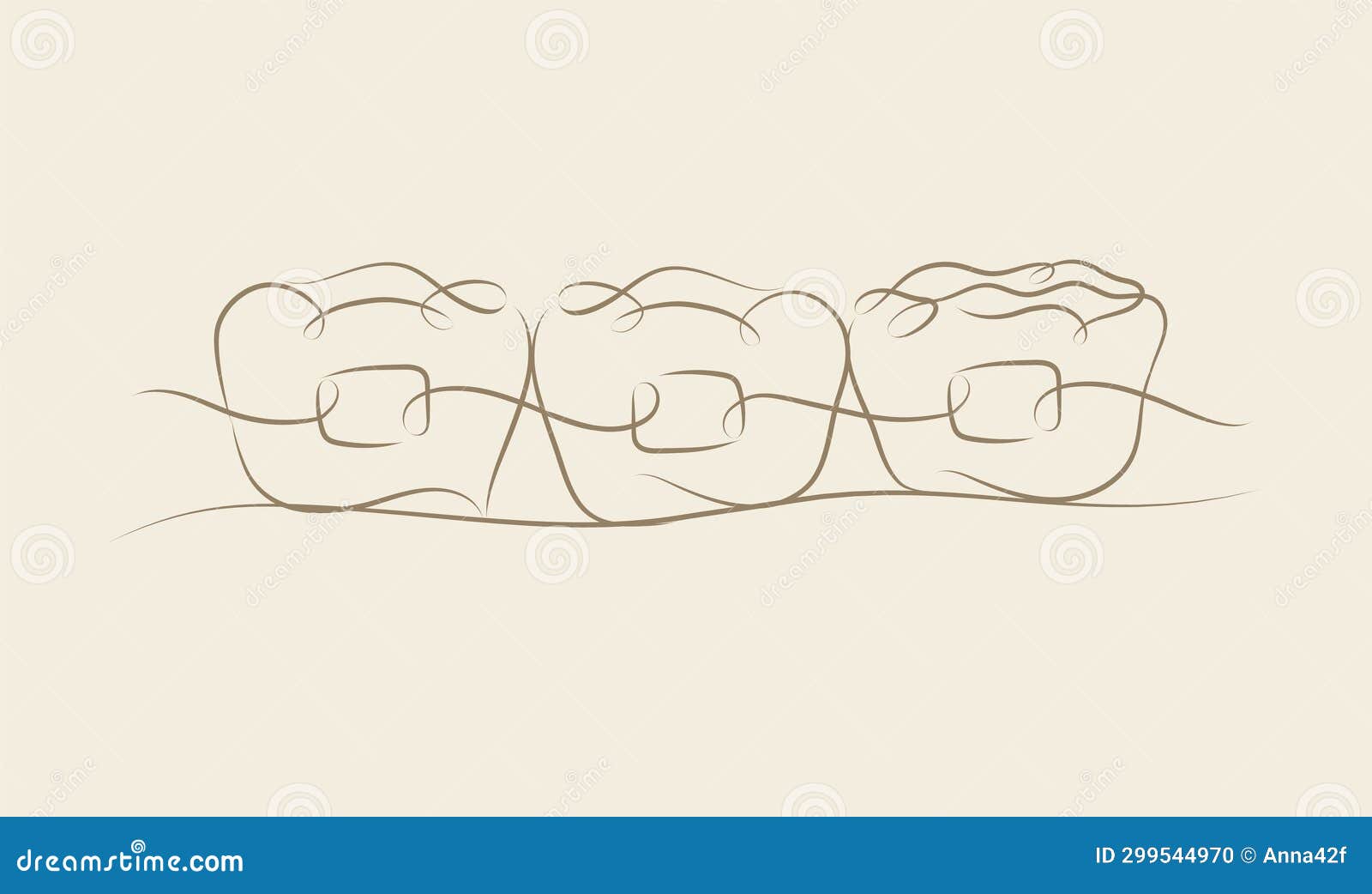 Teeth Braces Types Realistic Infographics Vector Illustration