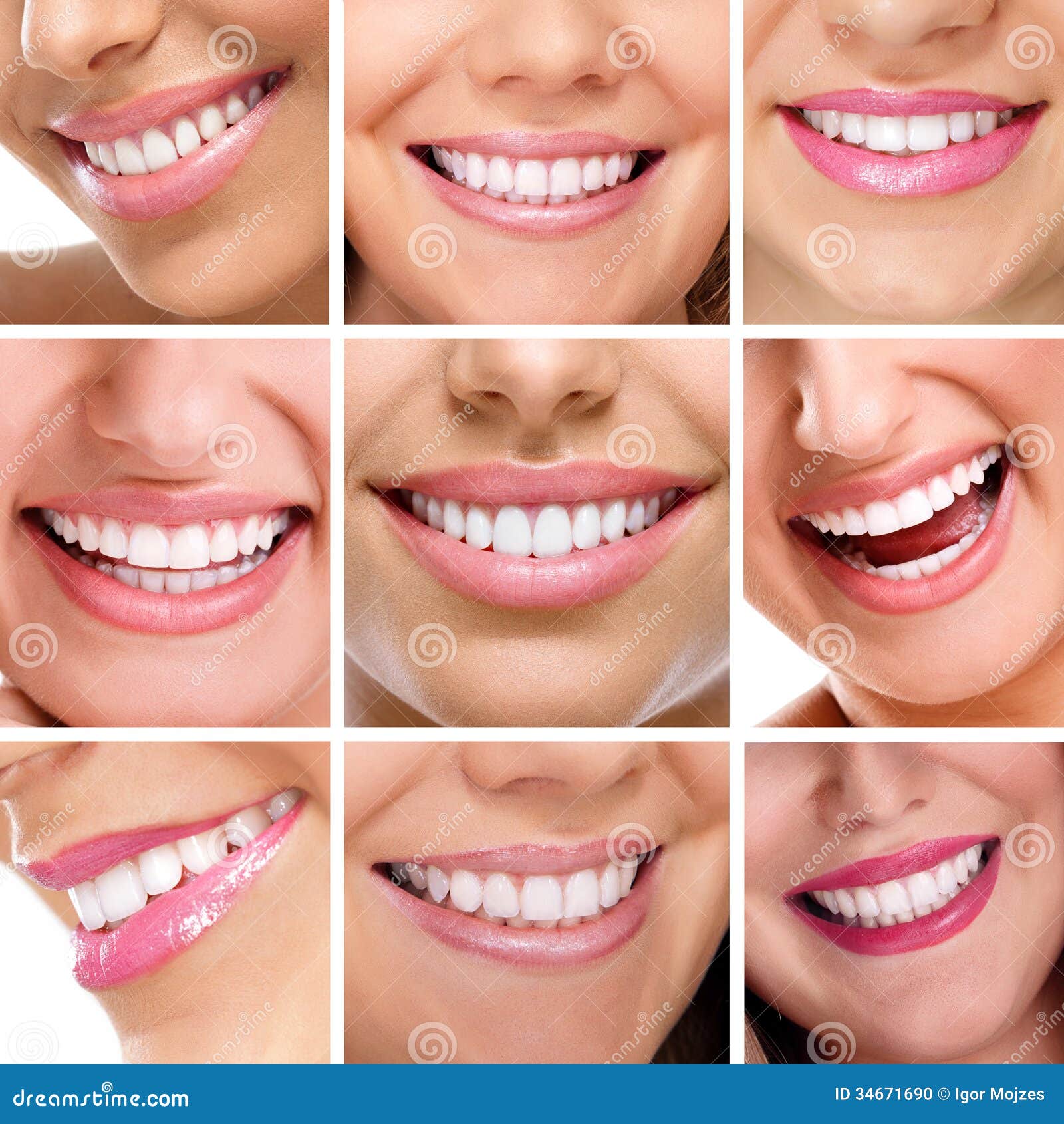 teeth collage of people smiles